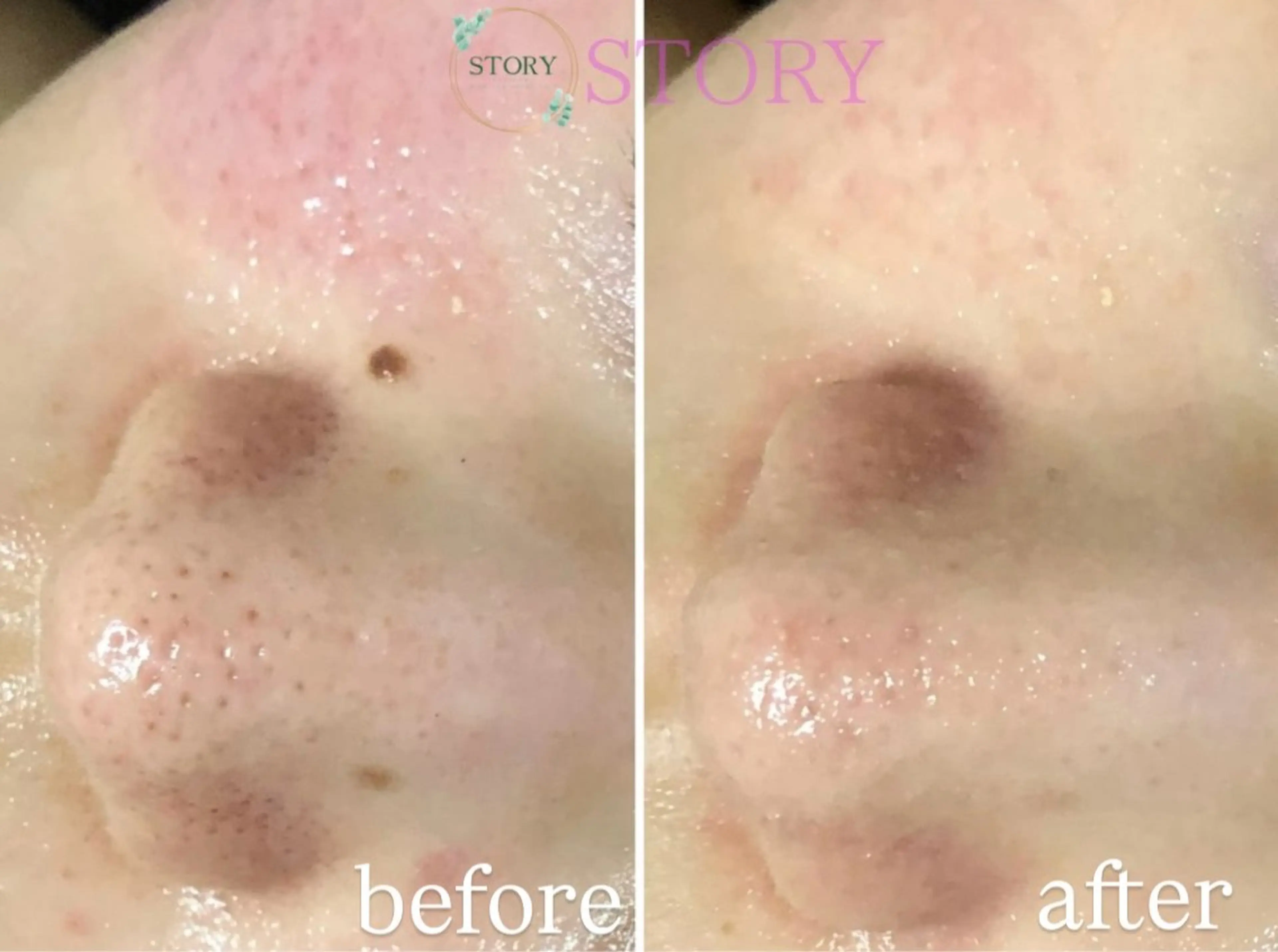 エステ 眉毛と艶肌ワックス専門店　STORY所属・Sasaki Tomokaの眉毛・アイブロウイメージ