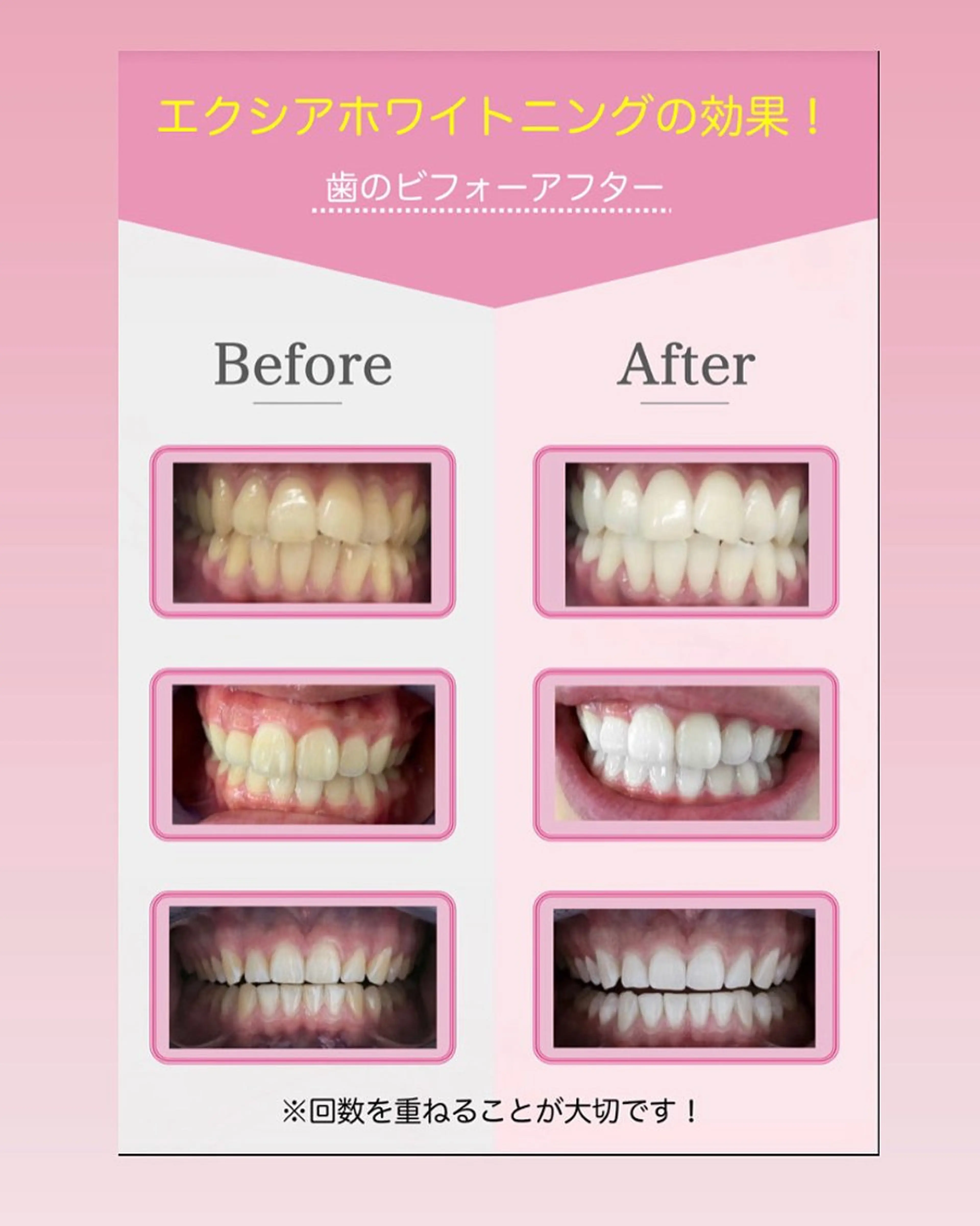 エクシアホワイトニング草津店所属・nanami -ホワイトニングのその他イメージ