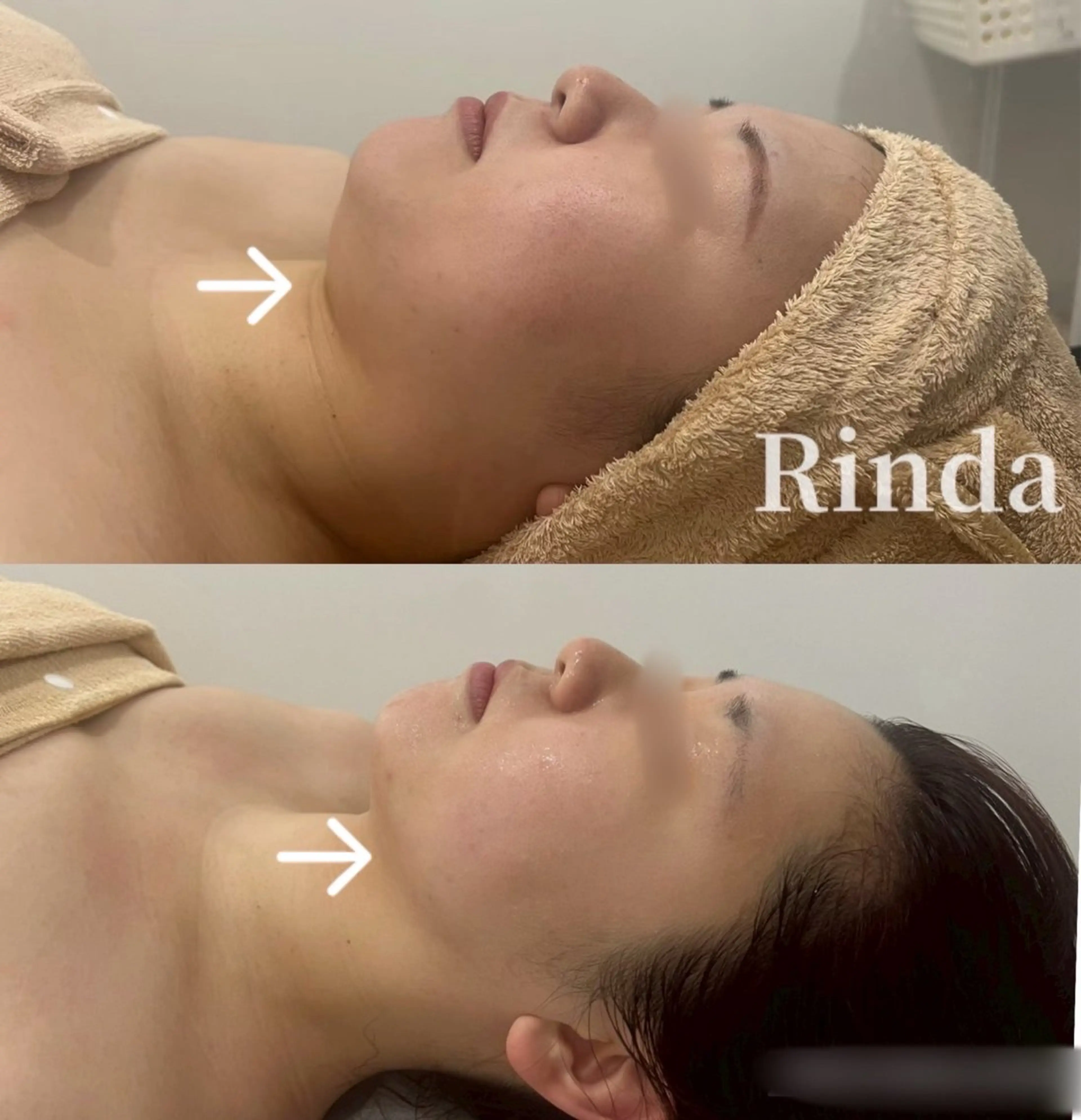 ブライダル痩身×脱毛 尼崎駅前サロンのエステ・リラクイメージ