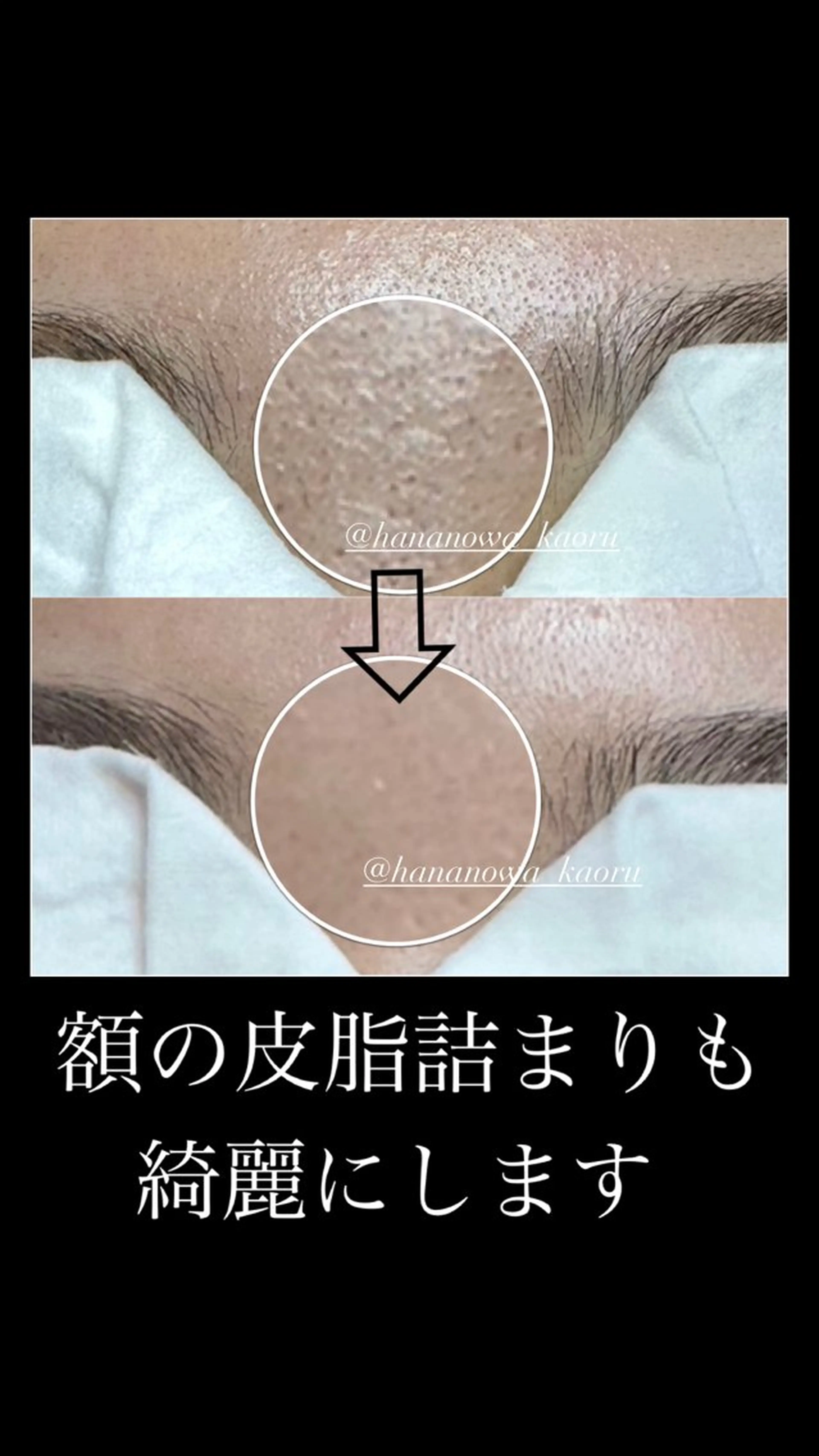 毛穴&リンパマッサージ専門サロン　花のWA所属・毛穴&リンパマッサー ジ専門サロン花のWAのエステ・リラクイメージ