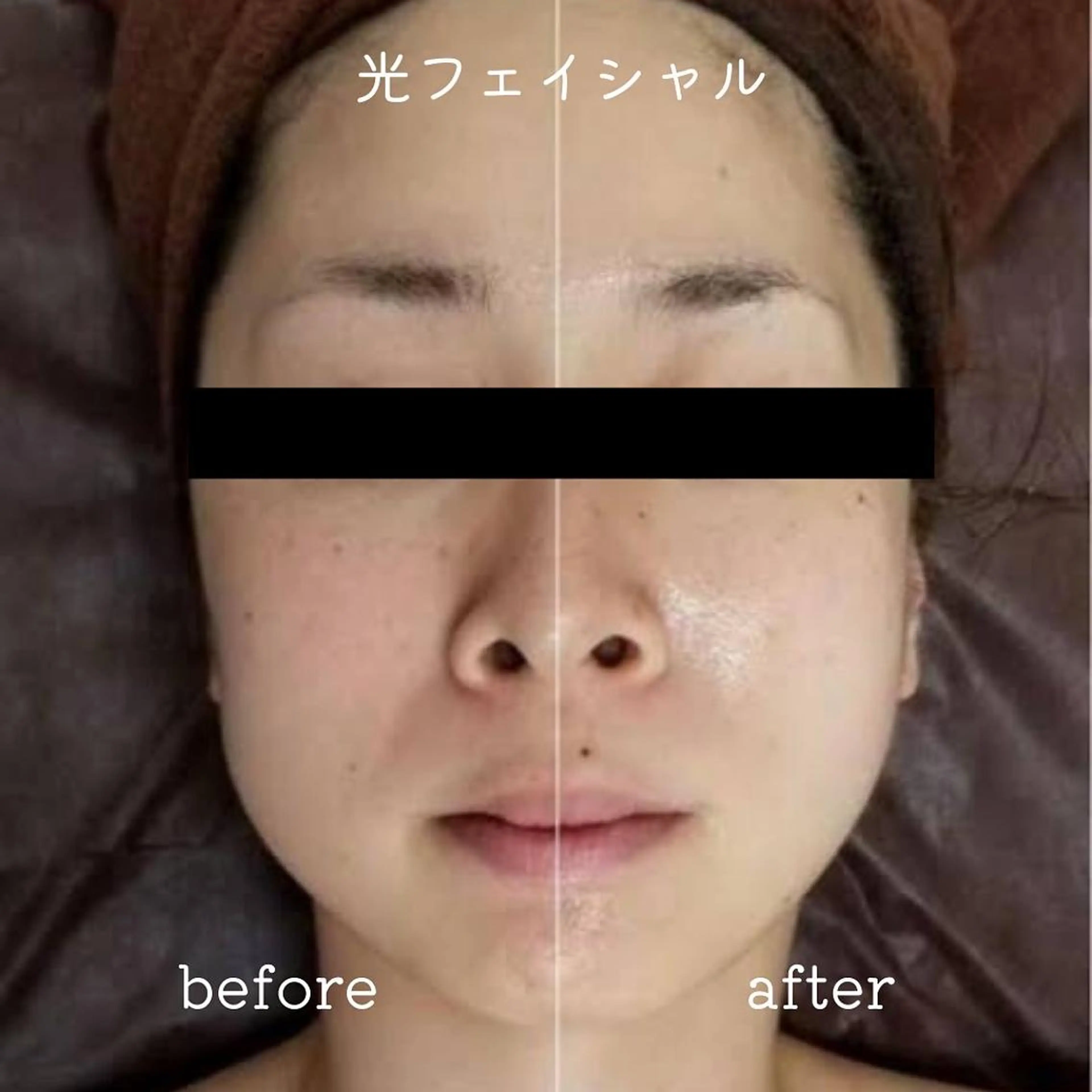 エステ リラク É LINDA所属・E LINDAのネイルデザイン