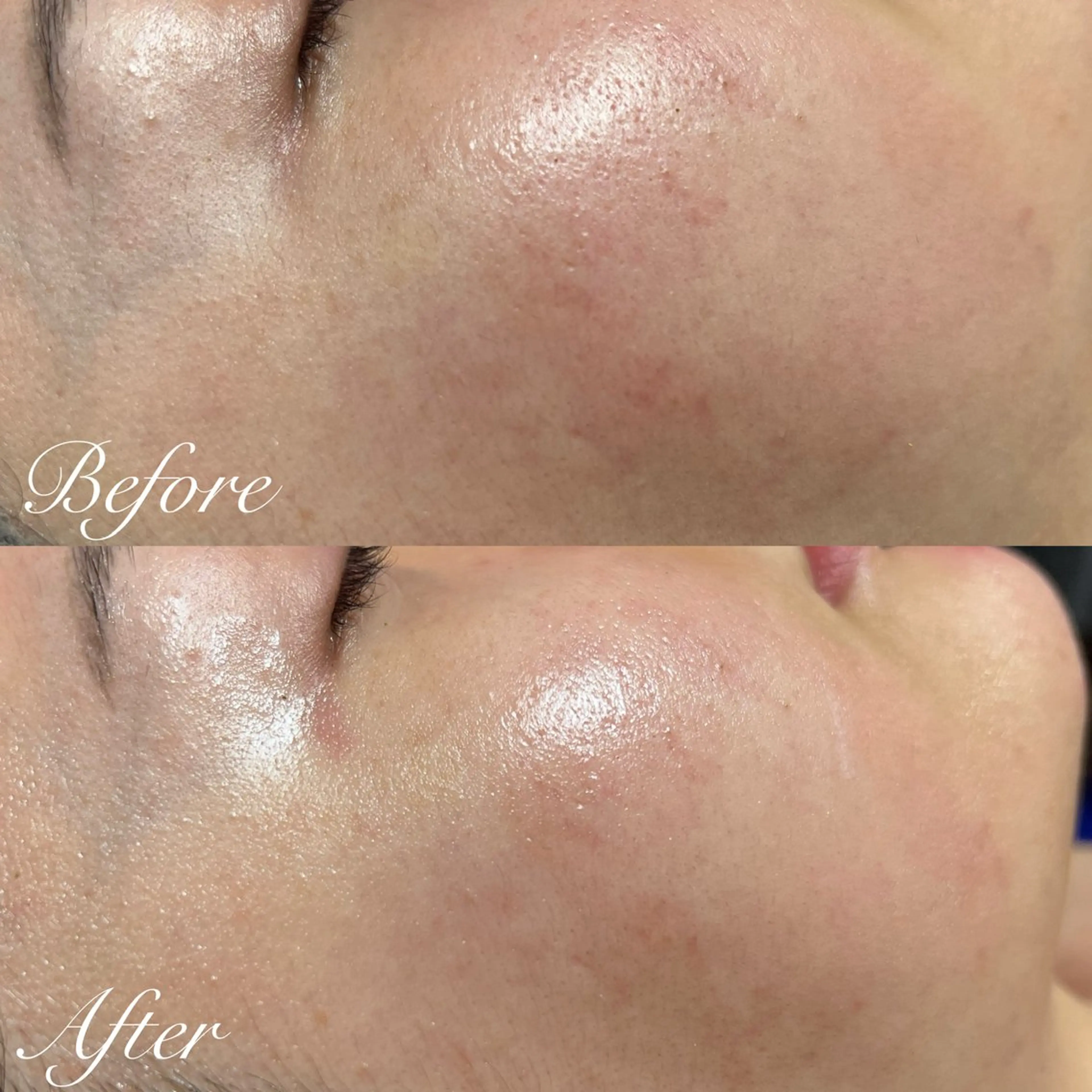 エステ シミ🩷ニキビ専門店 Matteo🎀✨のエステ・リラクイメージ