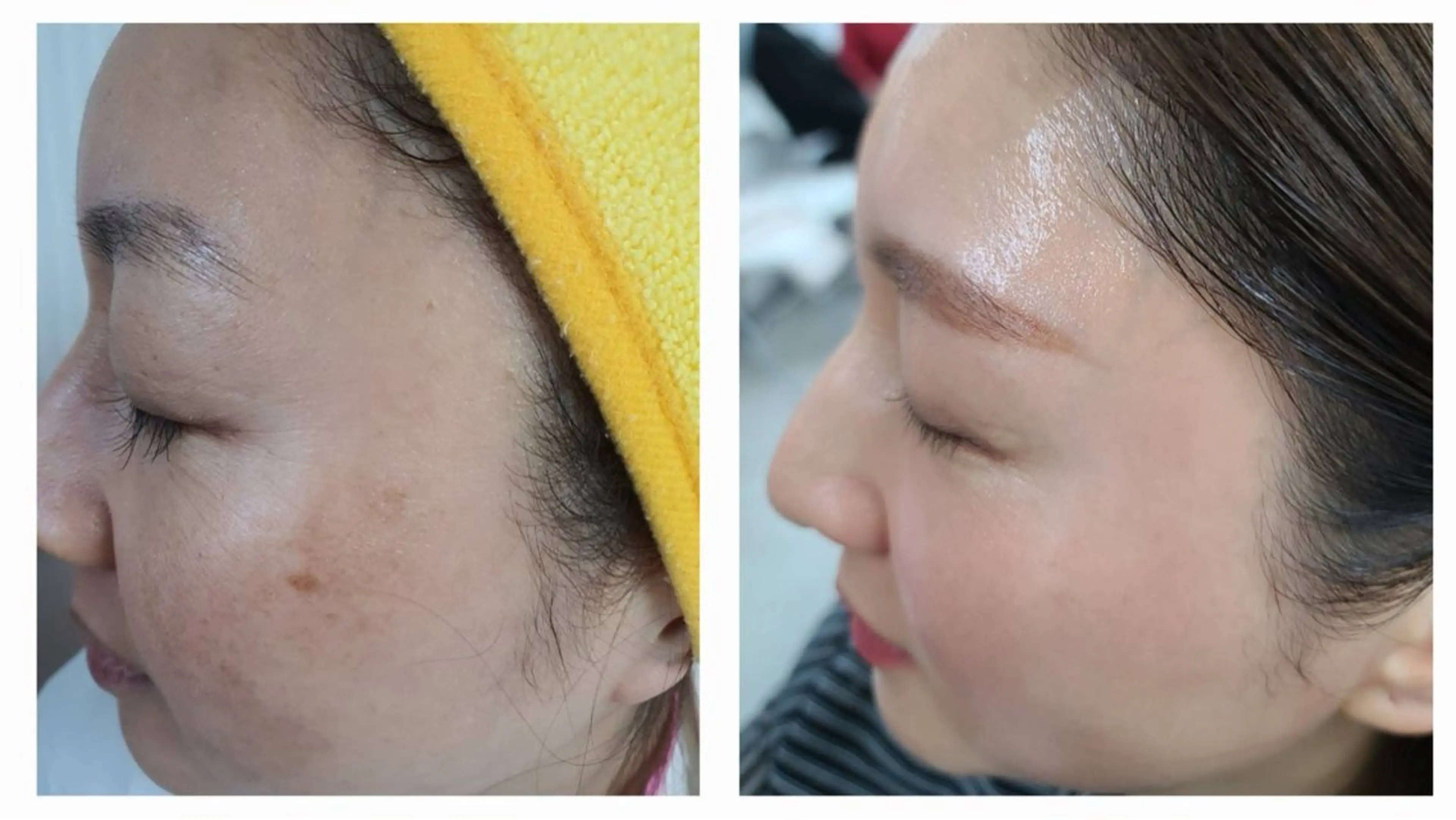 エステ 小顔/たるみ/黒ずみ除去専門サロン/SONA 大和西大寺店所属・【小顔専門看護師 サロンSONA】のエステ・リラクイメージ