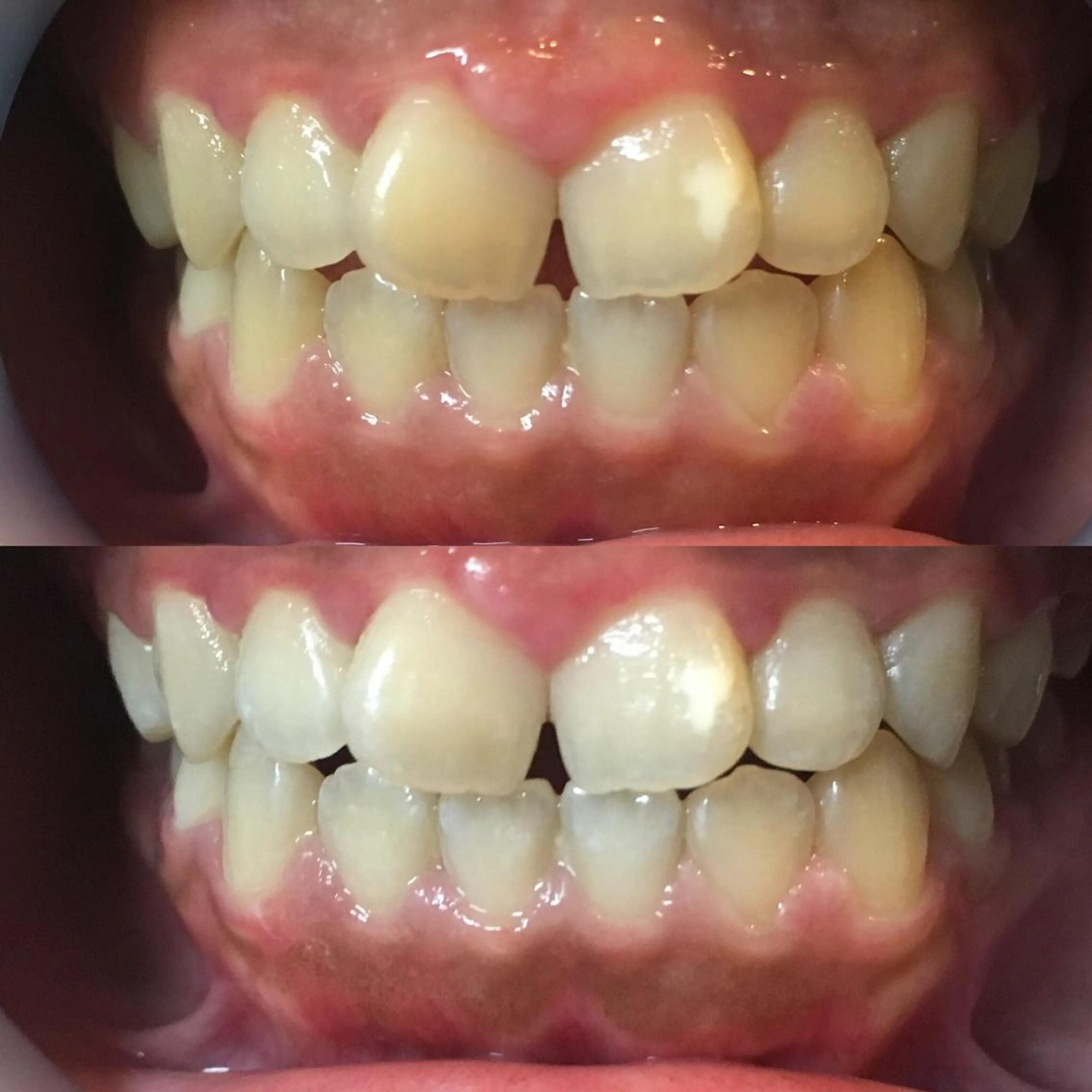 LBSホワイトニング 新宿店💝店長熊倉のその他イメージ