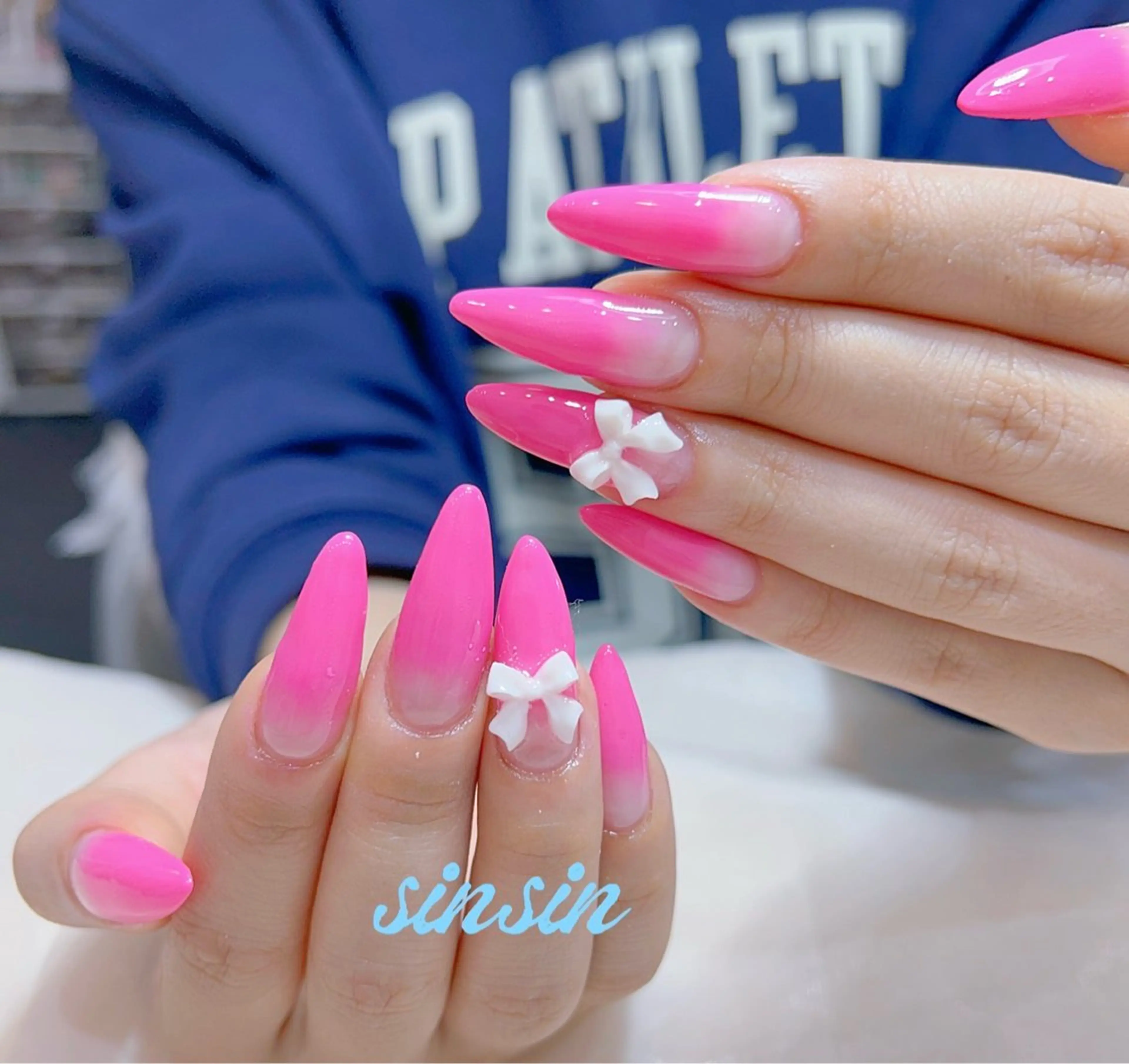 スカルプ】チップ長さだし放題コース(130分以内） ¥13000の写真