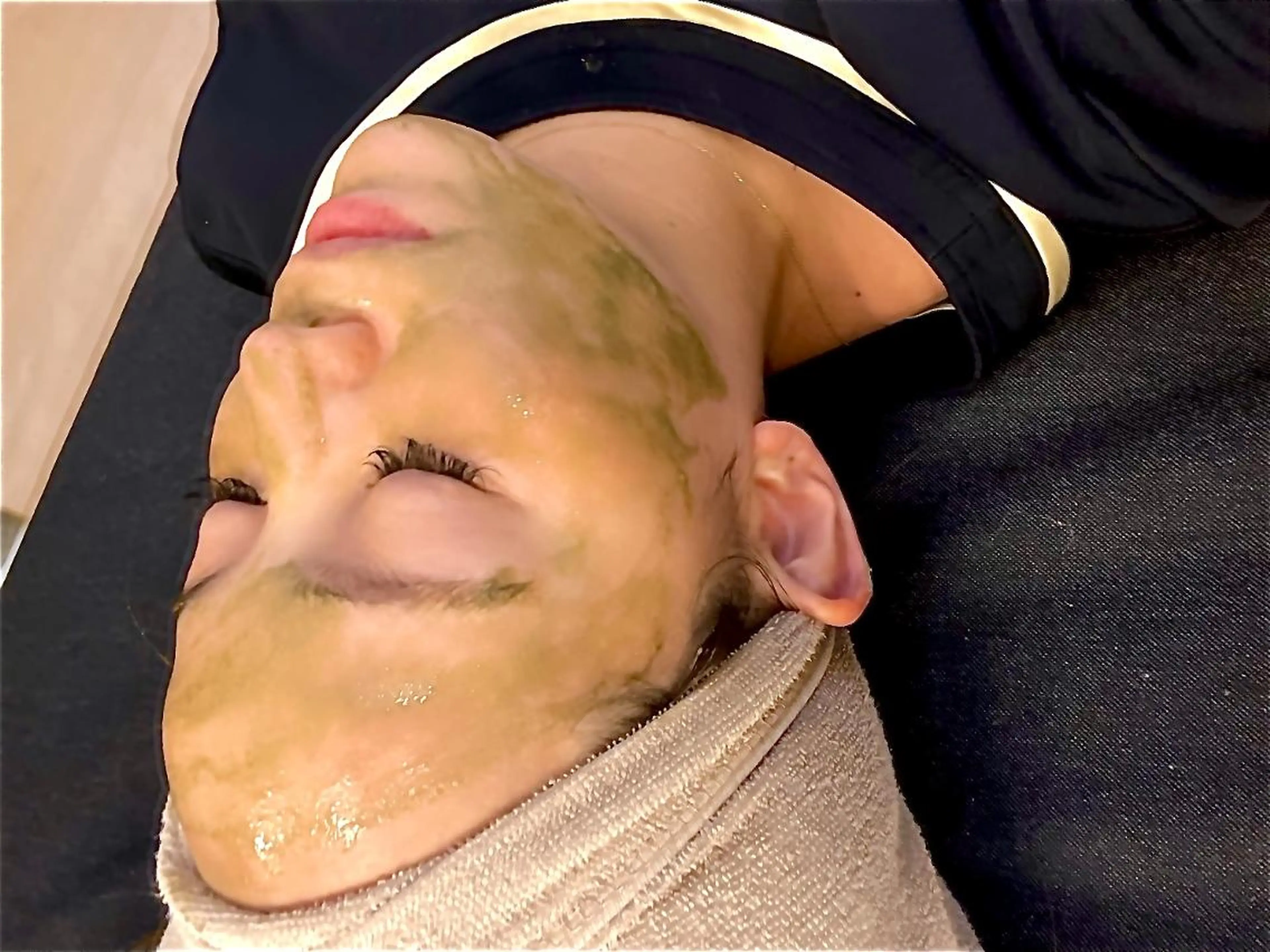 【特許取得ハーブピーリング】肌質改善!ニキビ・しみ・毛穴ケアを同時に¥7800の写真