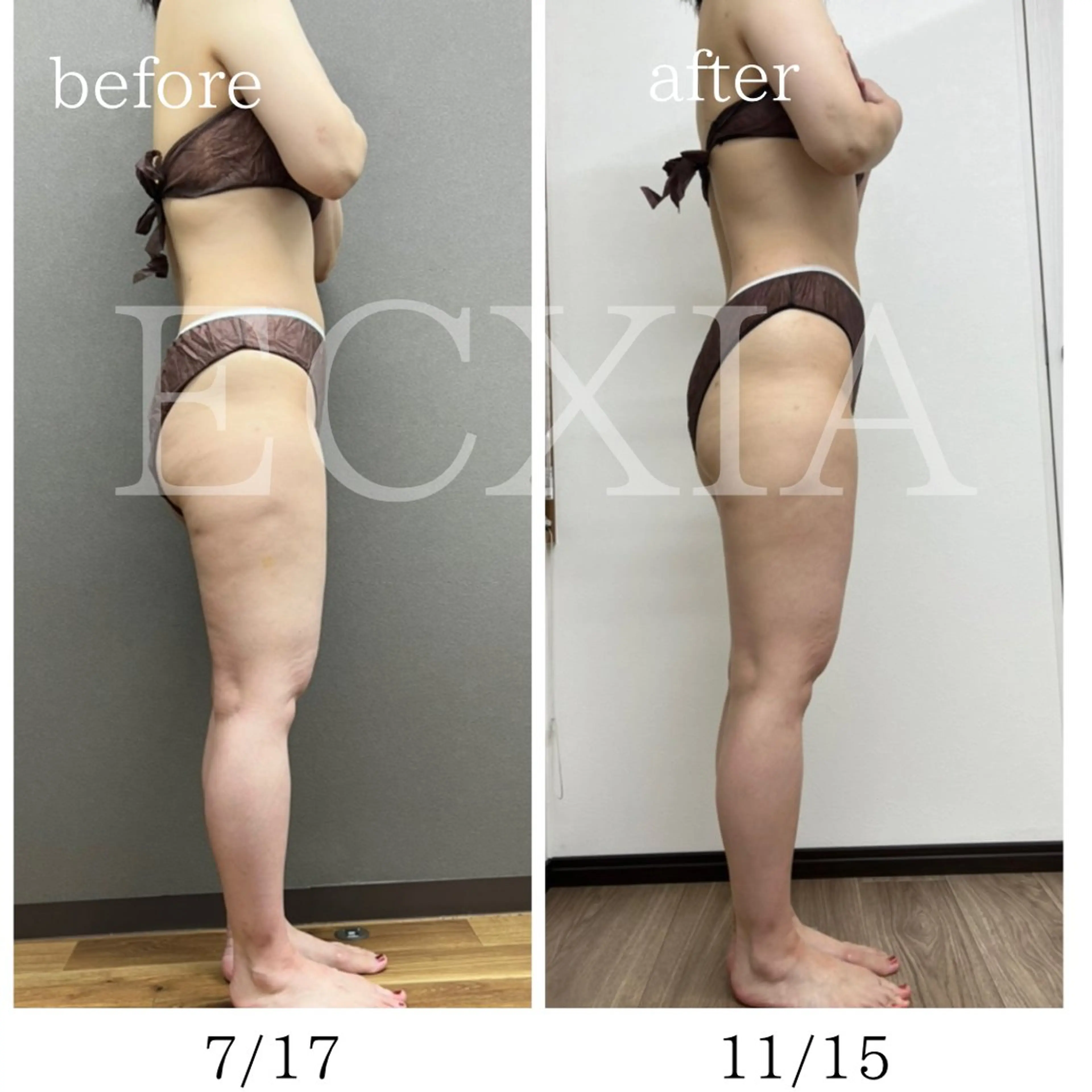 エステ リラク ECXIA 【エクシア】のエステ・リラクイメージ