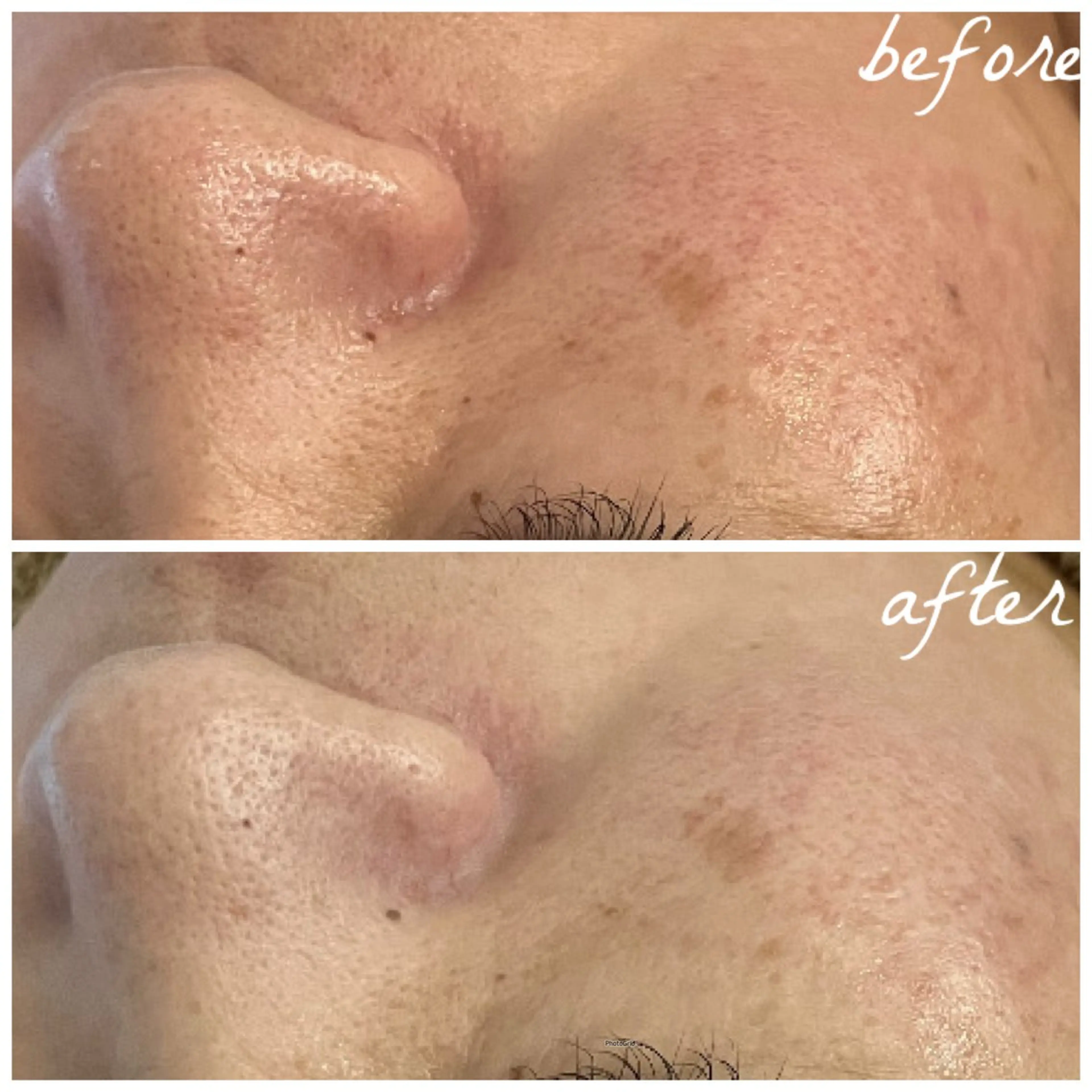 メンズ エステ メナード岐阜茜部 杉浦のエステ・リラクイメージ