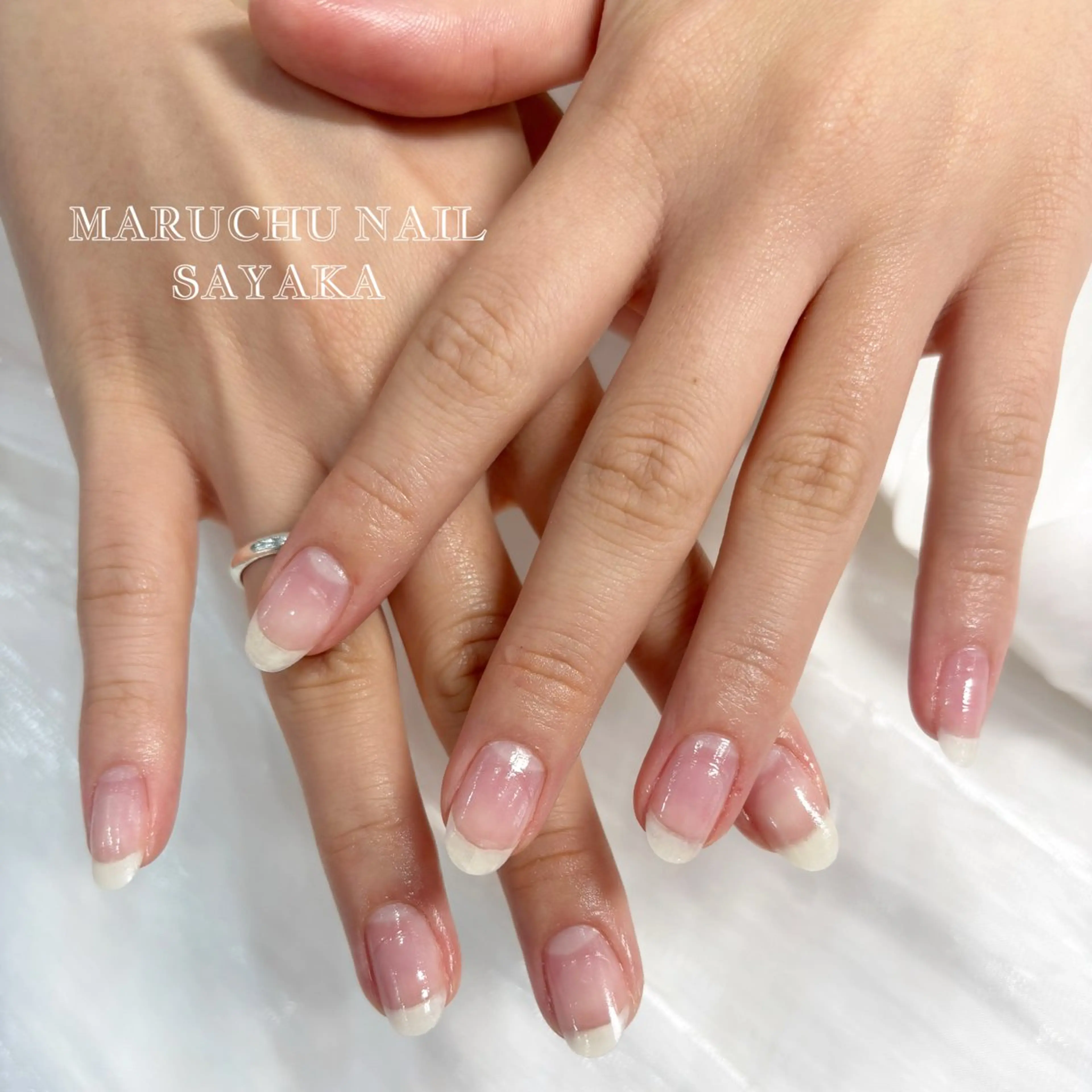 自爪オフ　ケア付き✨の写真