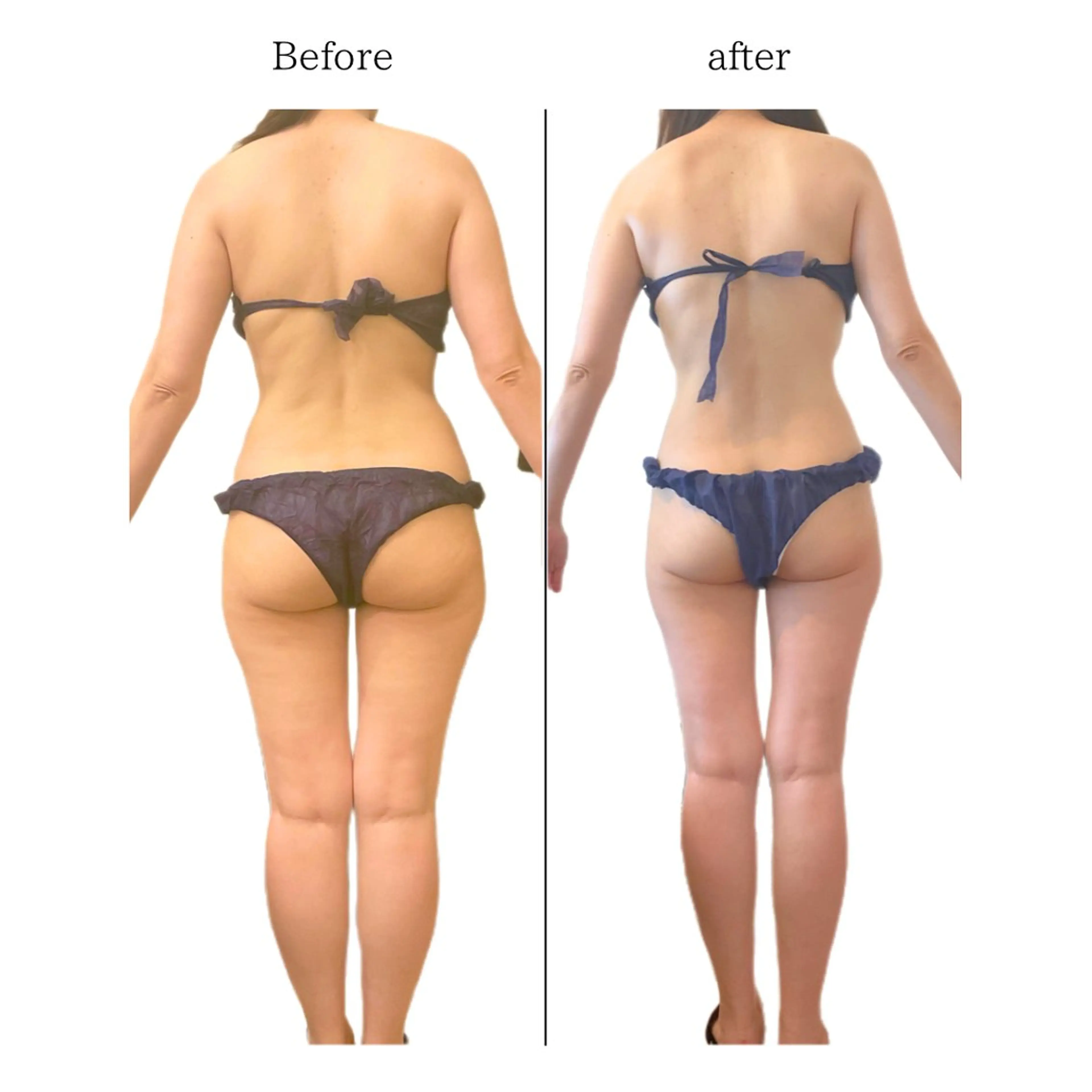 エステ リラク 痩身専門サロン Coral✨のエステ・リラクイメージ