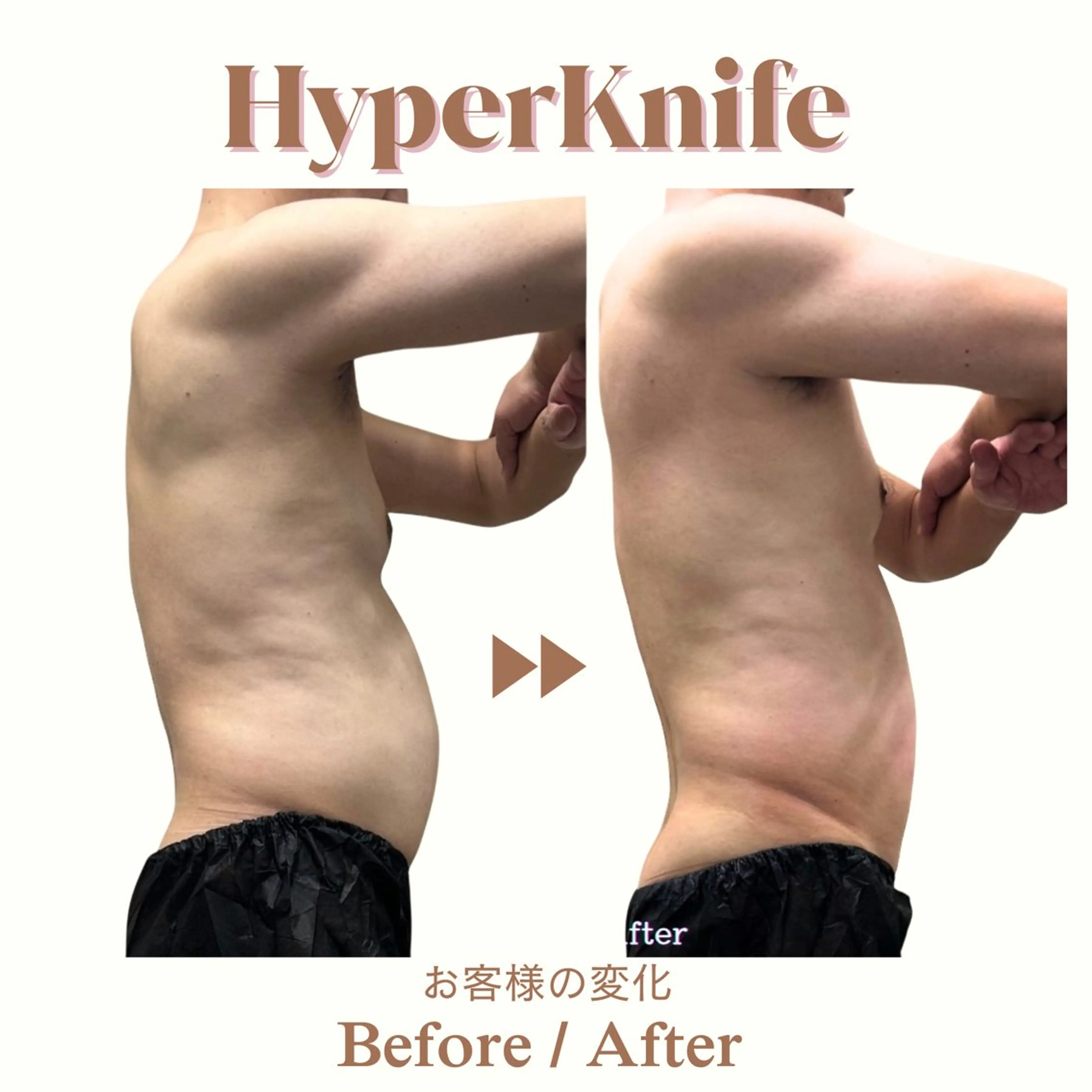 エステ aimer 服部のその他イメージ