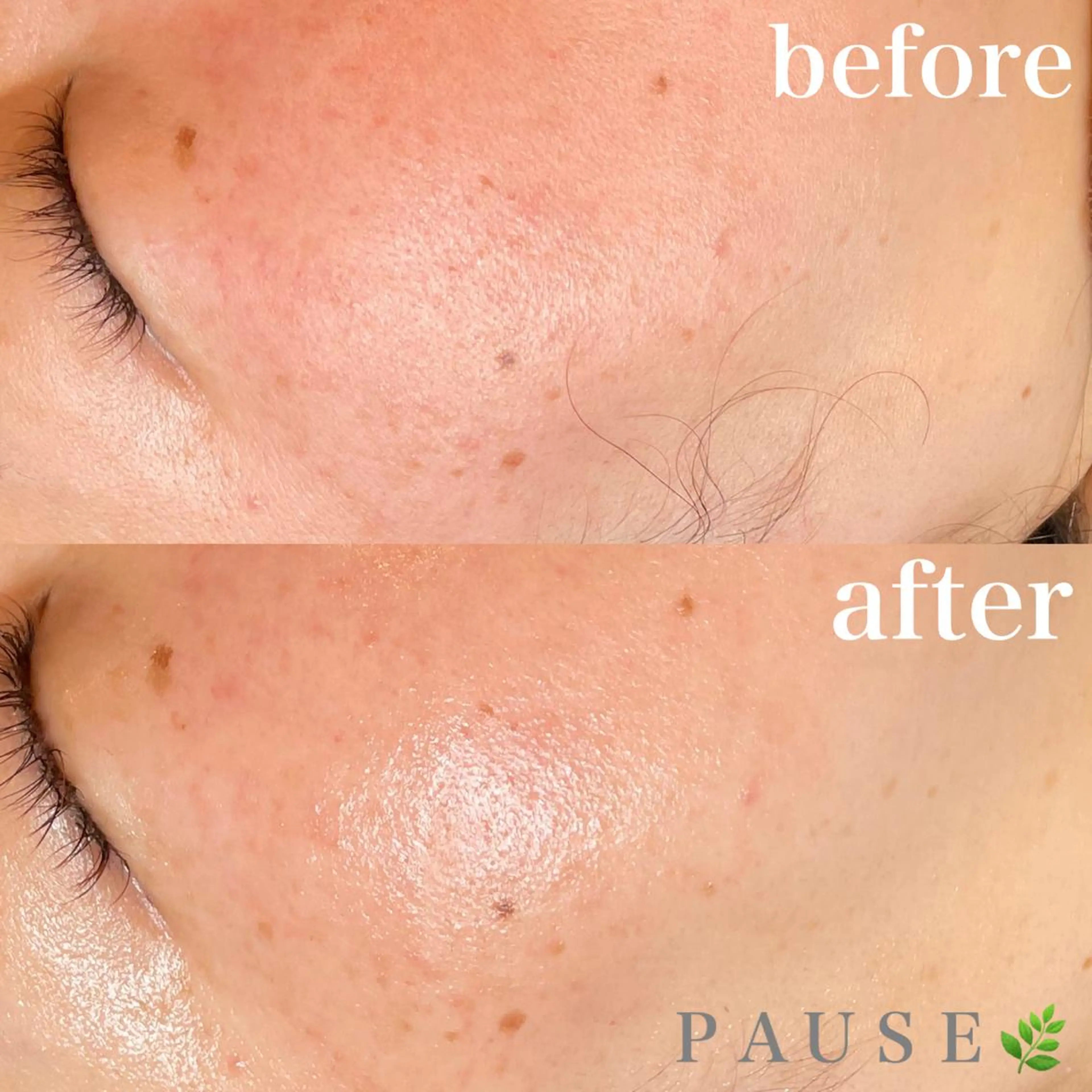 エステ 浜野 恵美のエステ・リラクイメージ