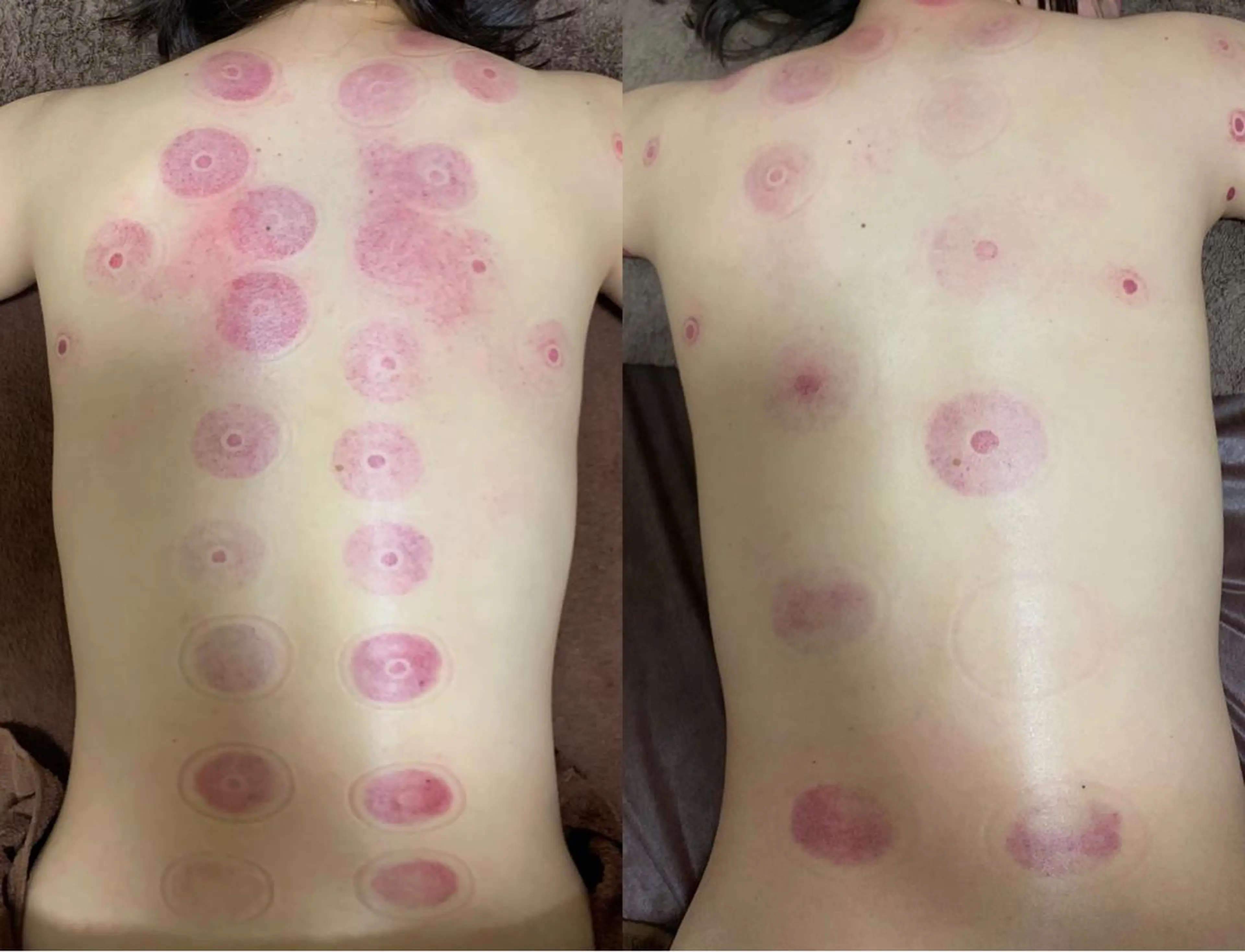 a  room salonのエステ・リラクイメージ