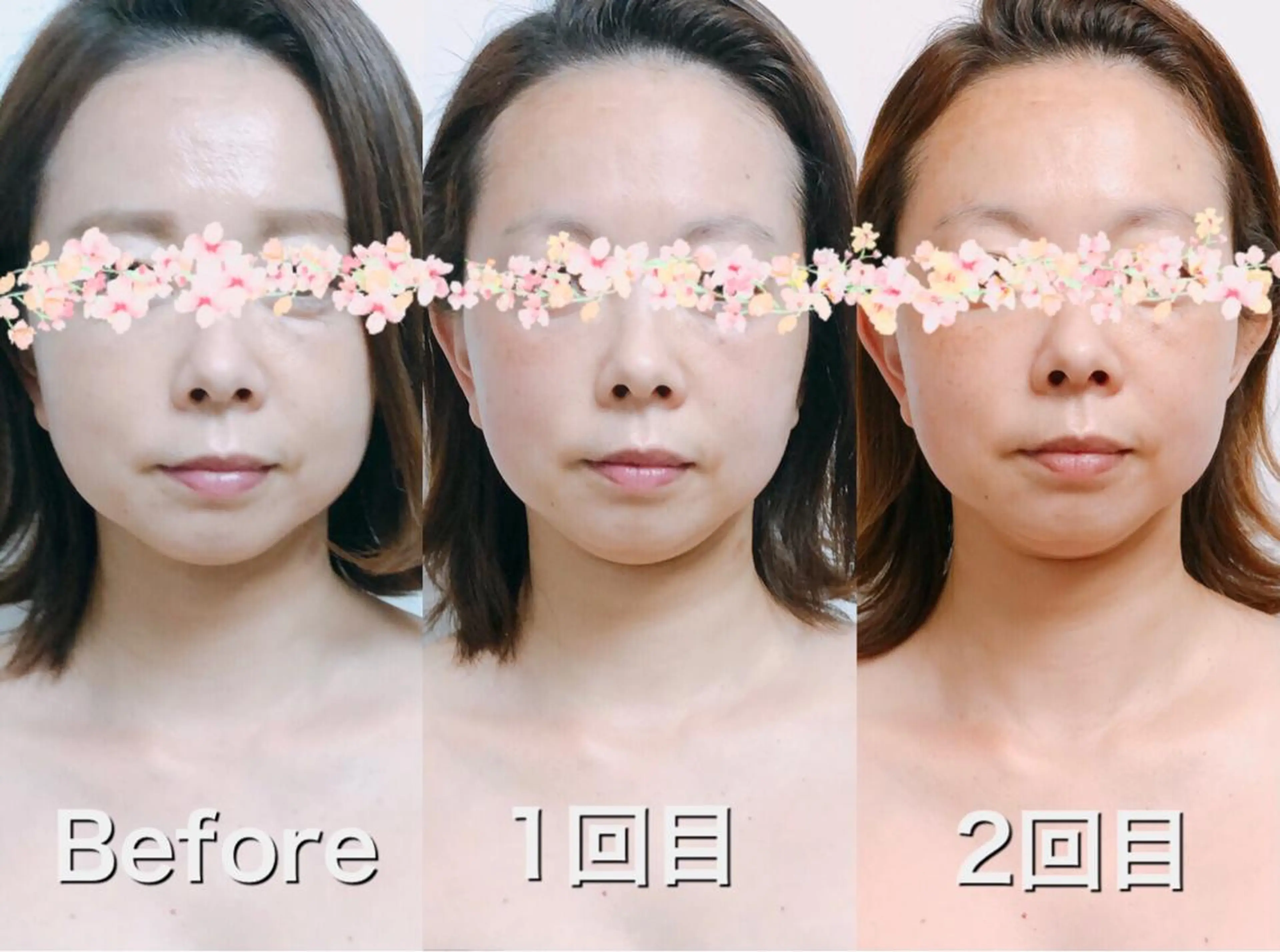 Mie Mie~ミイミイ~所属・セラピスト Miyawakiのエステ・リラクイメージ