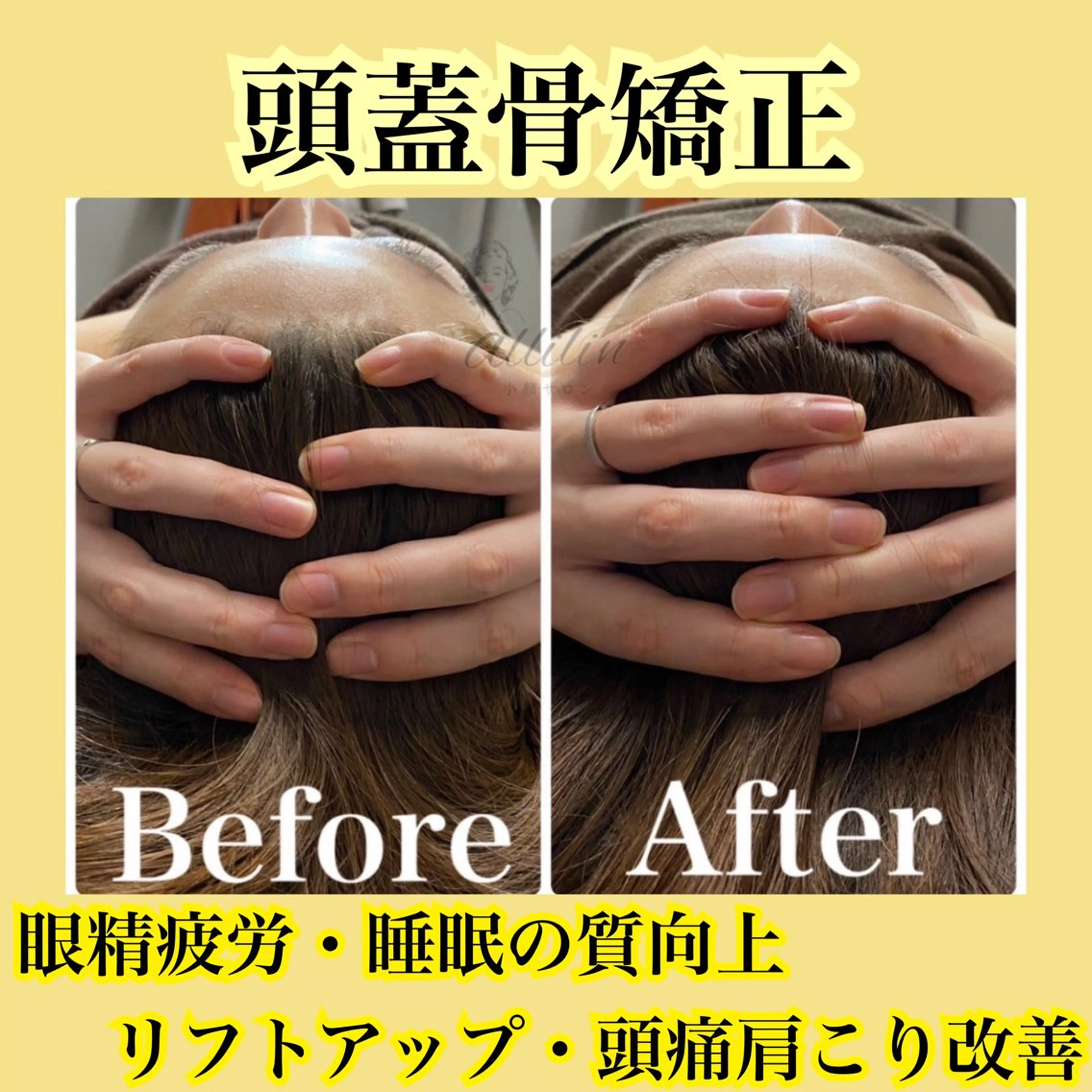 小顔サロン アリリン 🌷銀座Kannaのエステ・リラクイメージ