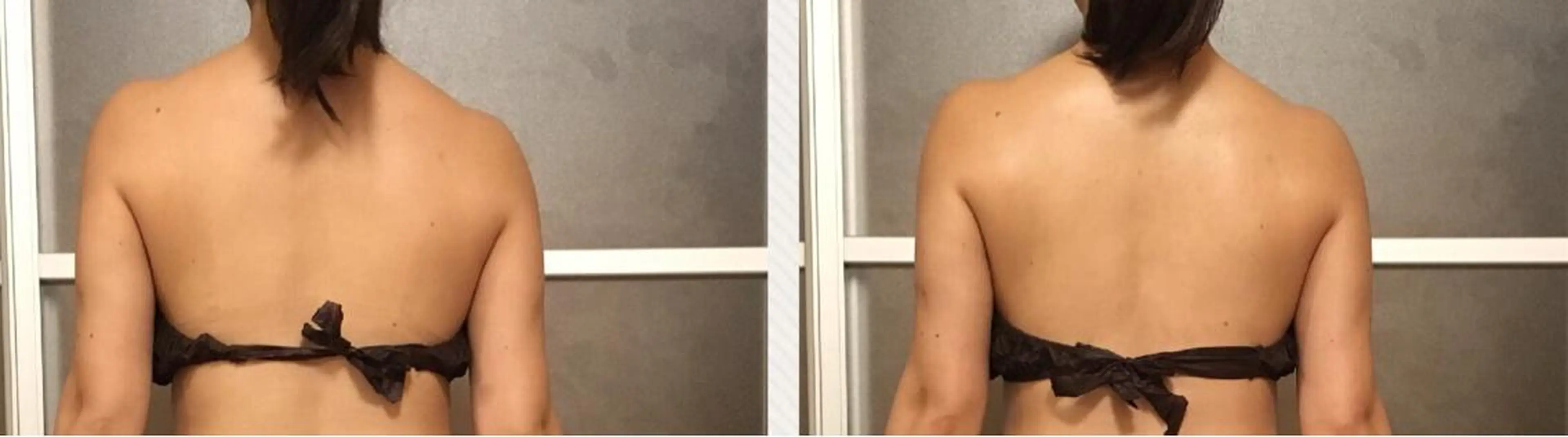 セミロング カラー パーマ ヘアアレンジ メンズ キッズ ネイル マツエク・マツパ アニメ,Vオタク× 即効痩せエステサロンのエステ・リラクイメージ