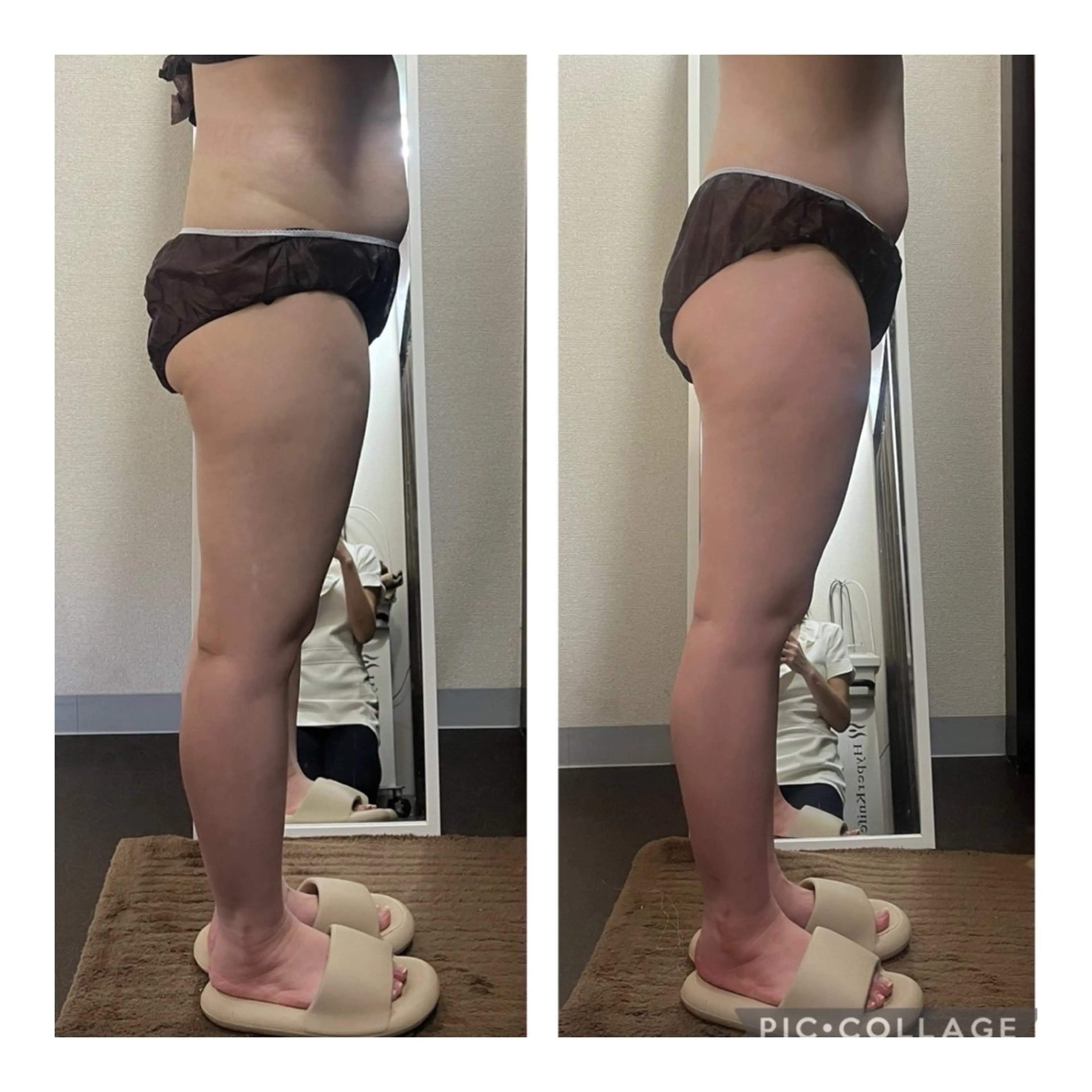 ハイパーナイフ専門店　Salon de COCO所属・Salon de COCOのエステ・リラクイメージ