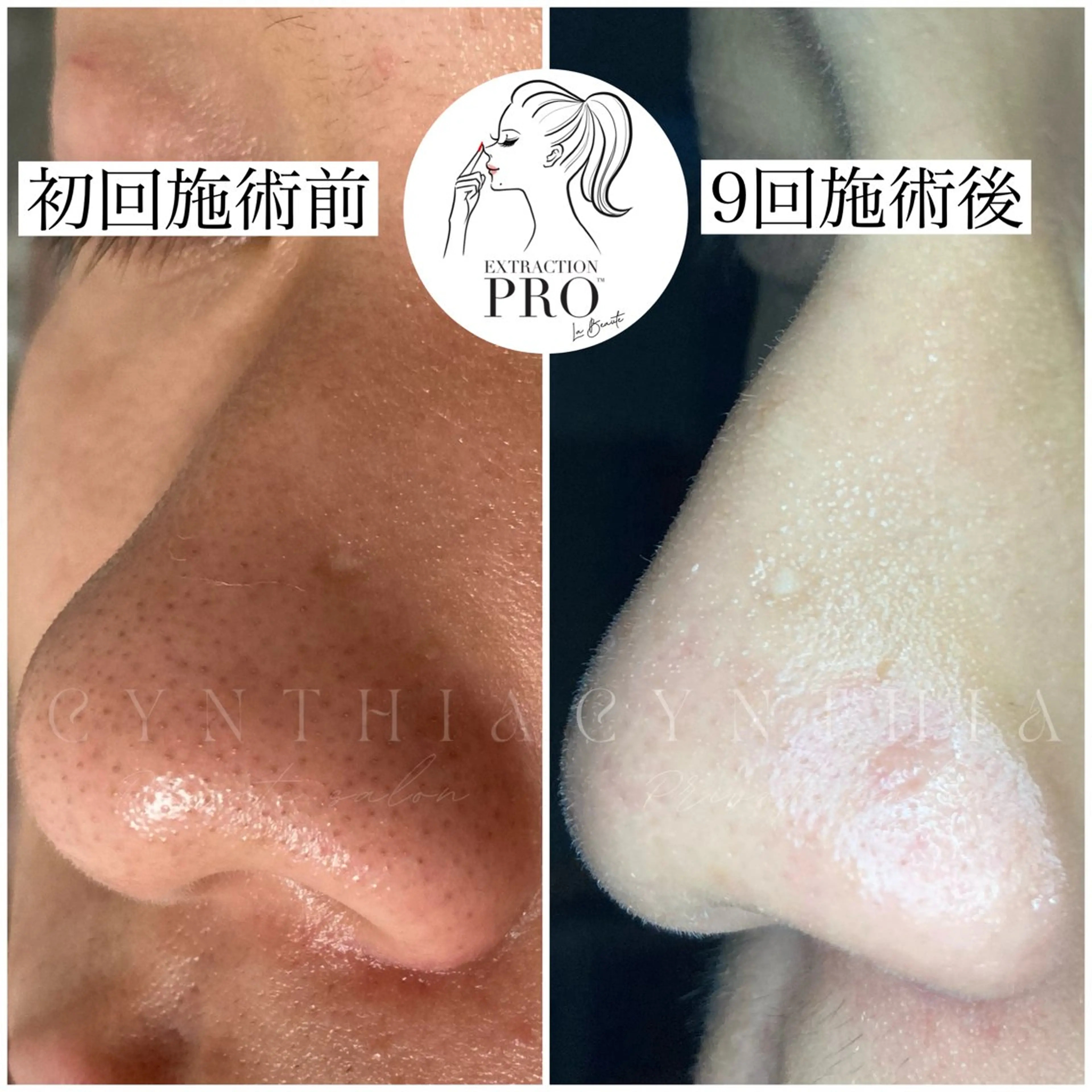 メンズ エステ 毛穴ケア専門店 Cynthiaのエステ・リラクイメージ