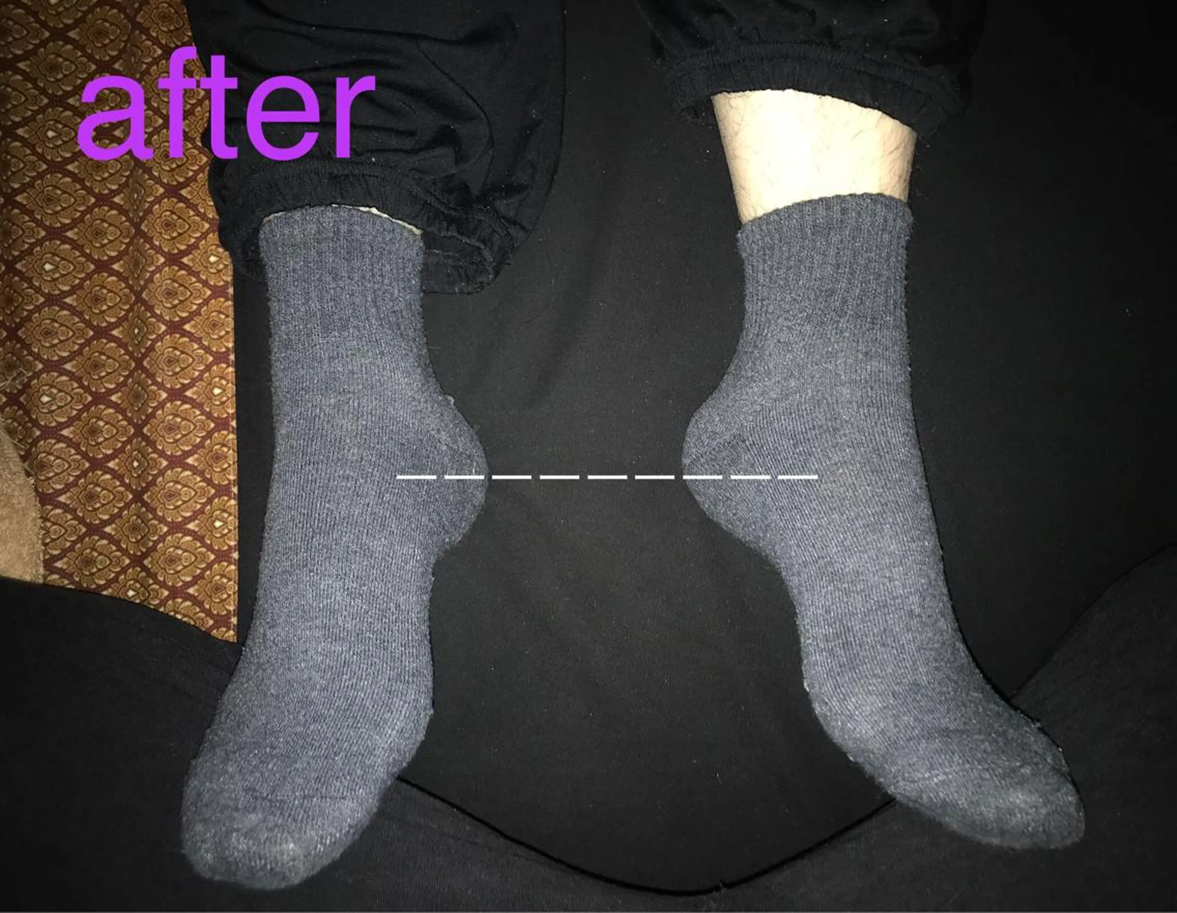 リラク 【足圧】鬼👹リンパ 身体整うサロンのエステ・リラクイメージ