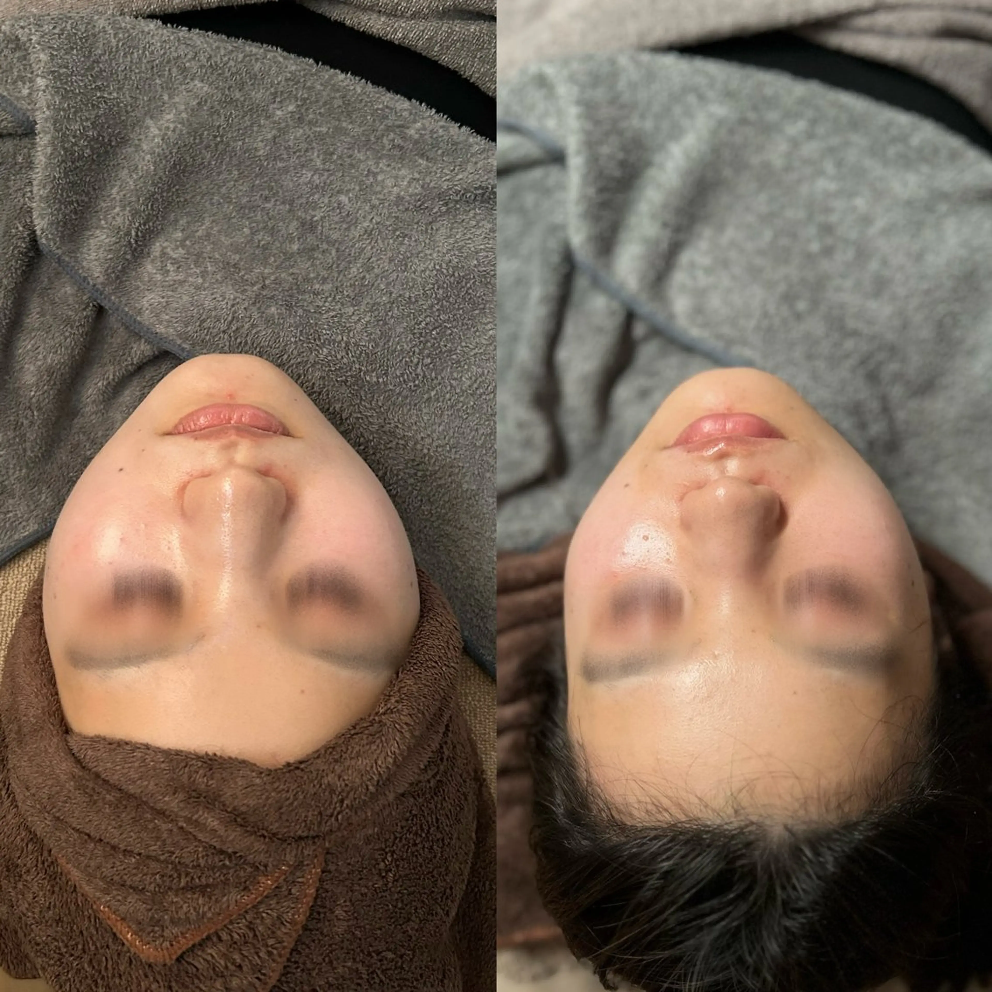 エステ Smoo アユミの眉毛・アイブロウイメージ