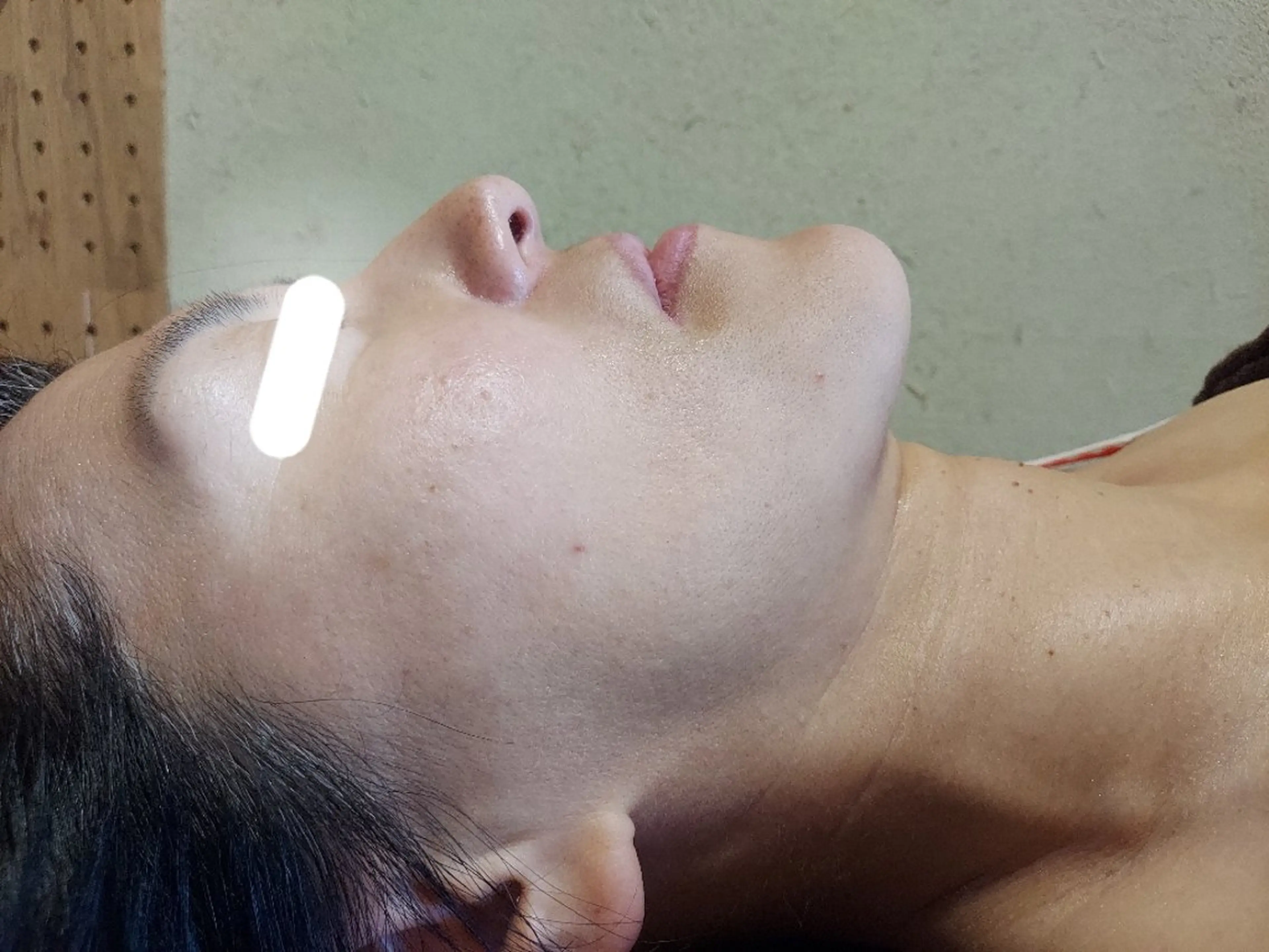 紫外線ダメージ集中補修！横顔美人－5歳シミたるみシワも解決！の写真