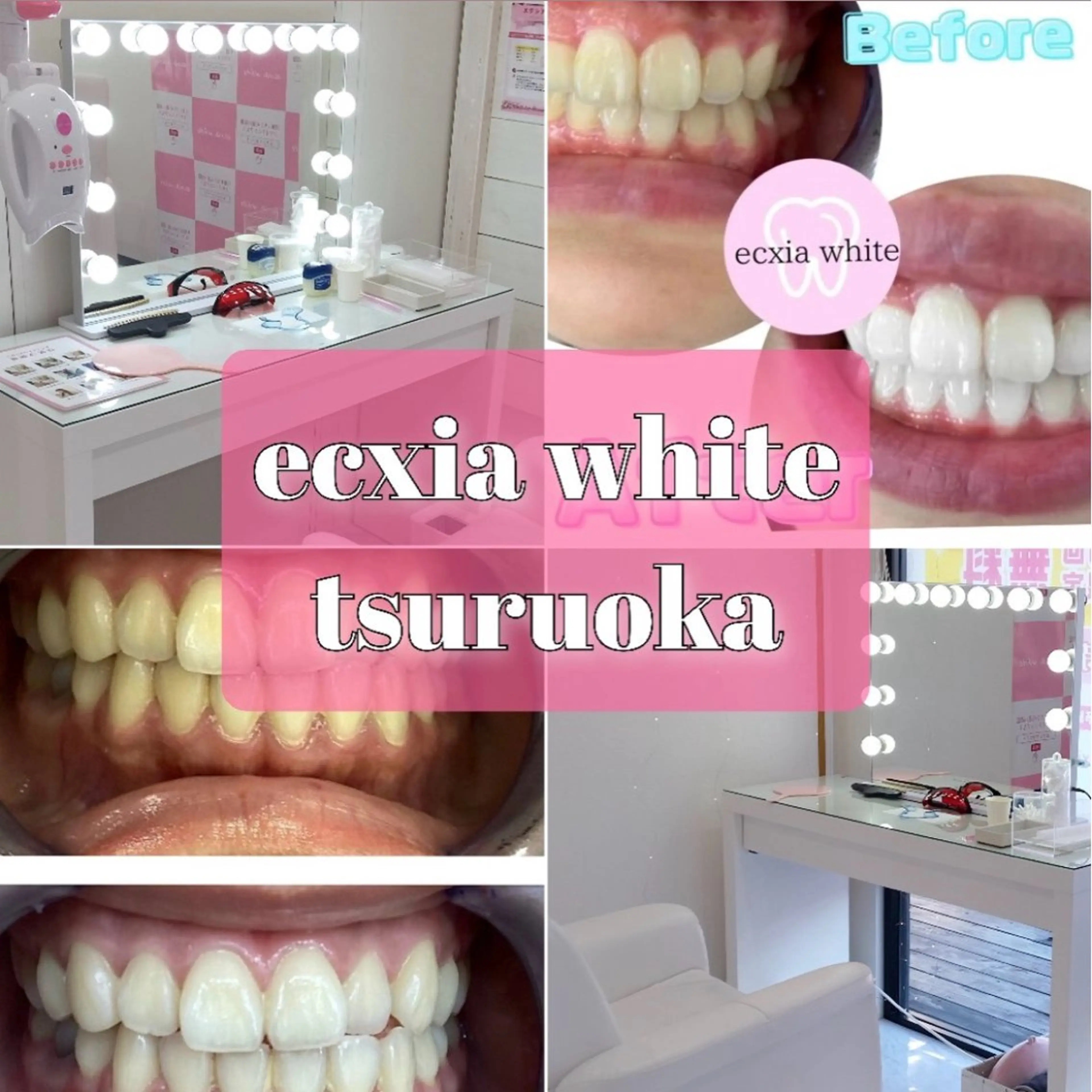 エクシアホワイトニング鶴岡店所属・ecxia鶴岡店 /さくらのその他イメージ