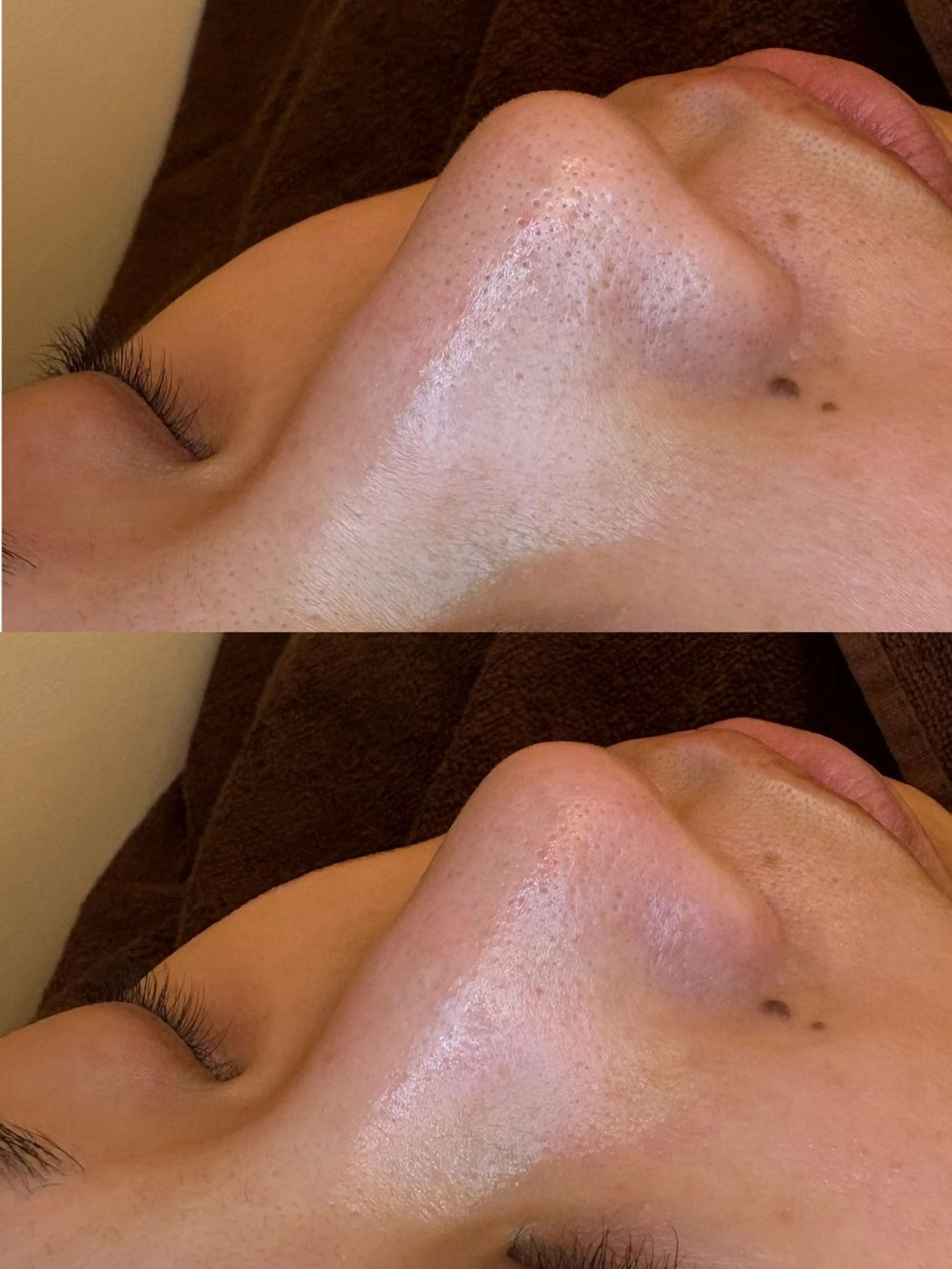 エステ EARTH coiffure beaute 新潟紫竹山店所属・🤍アベシュリ /フェイシャル🤍のエステ・リラクイメージ