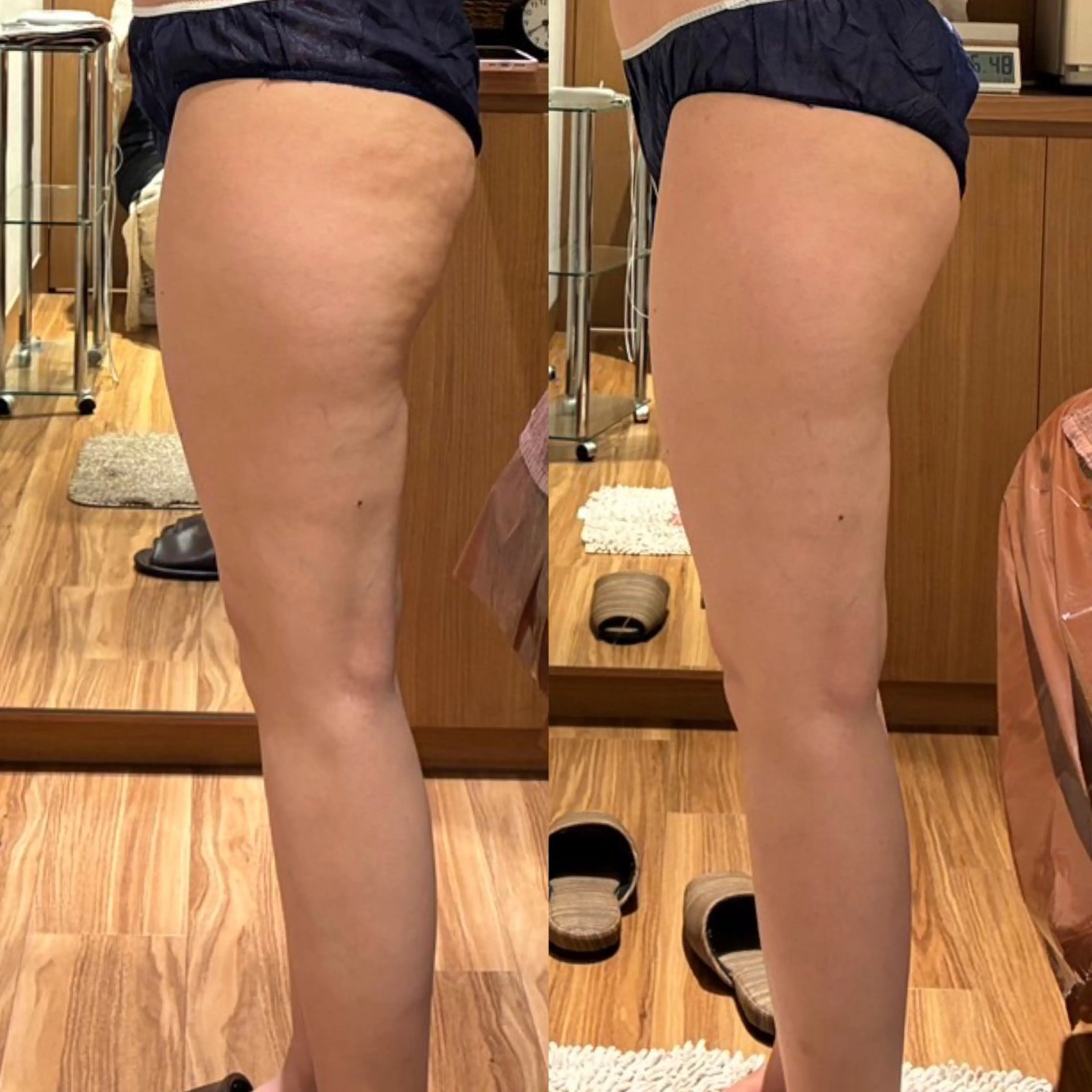 パルティール渋谷店所属・神宮司 はるかのエステ・リラクイメージ