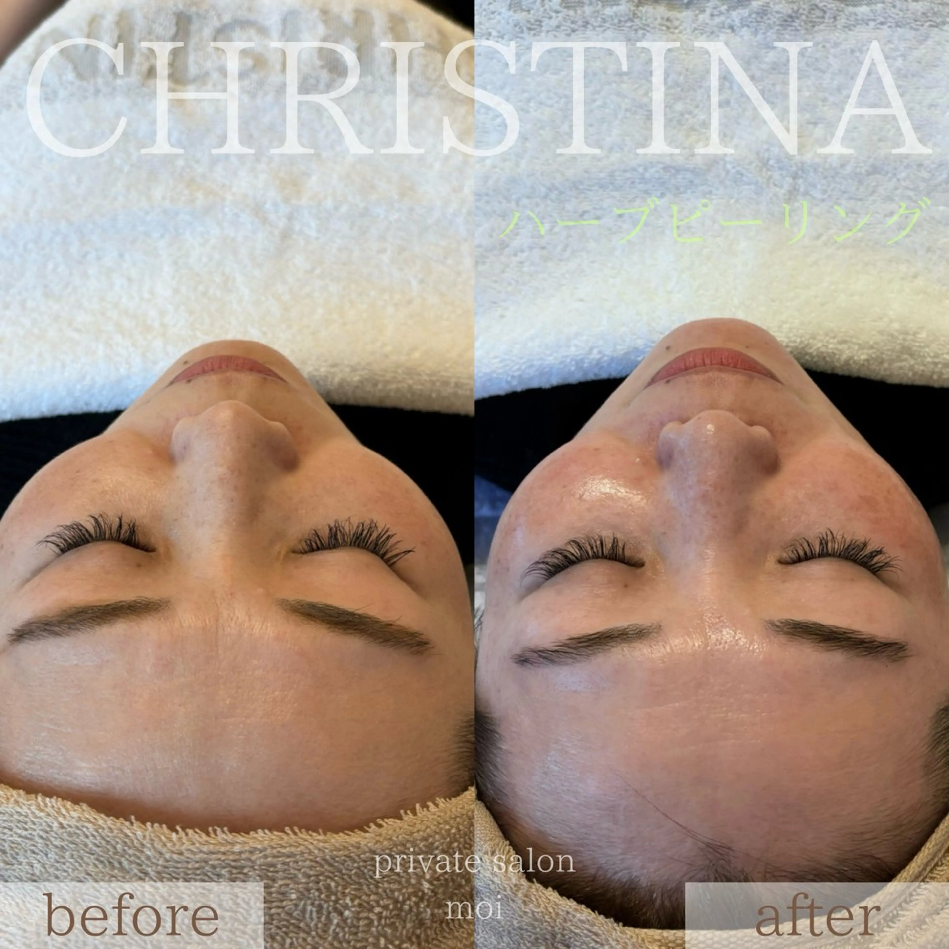 salon moi(モア)のエステ・リラクイメージ