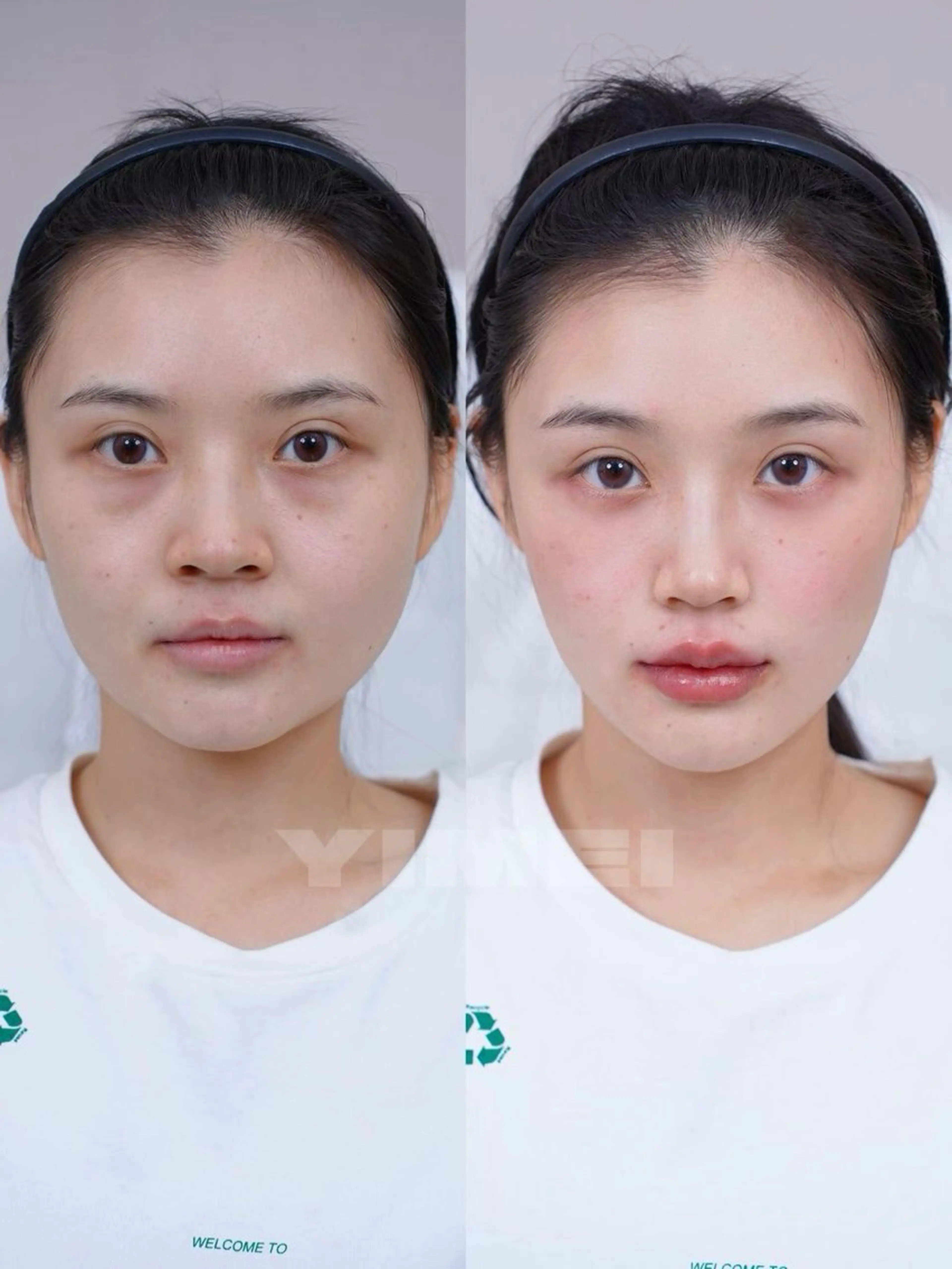 ネイル エステ aliaハイフ&水光ジェットサロン所属・aliaハーブ水光店 エステティシャン募集のエステ・リラクイメージ