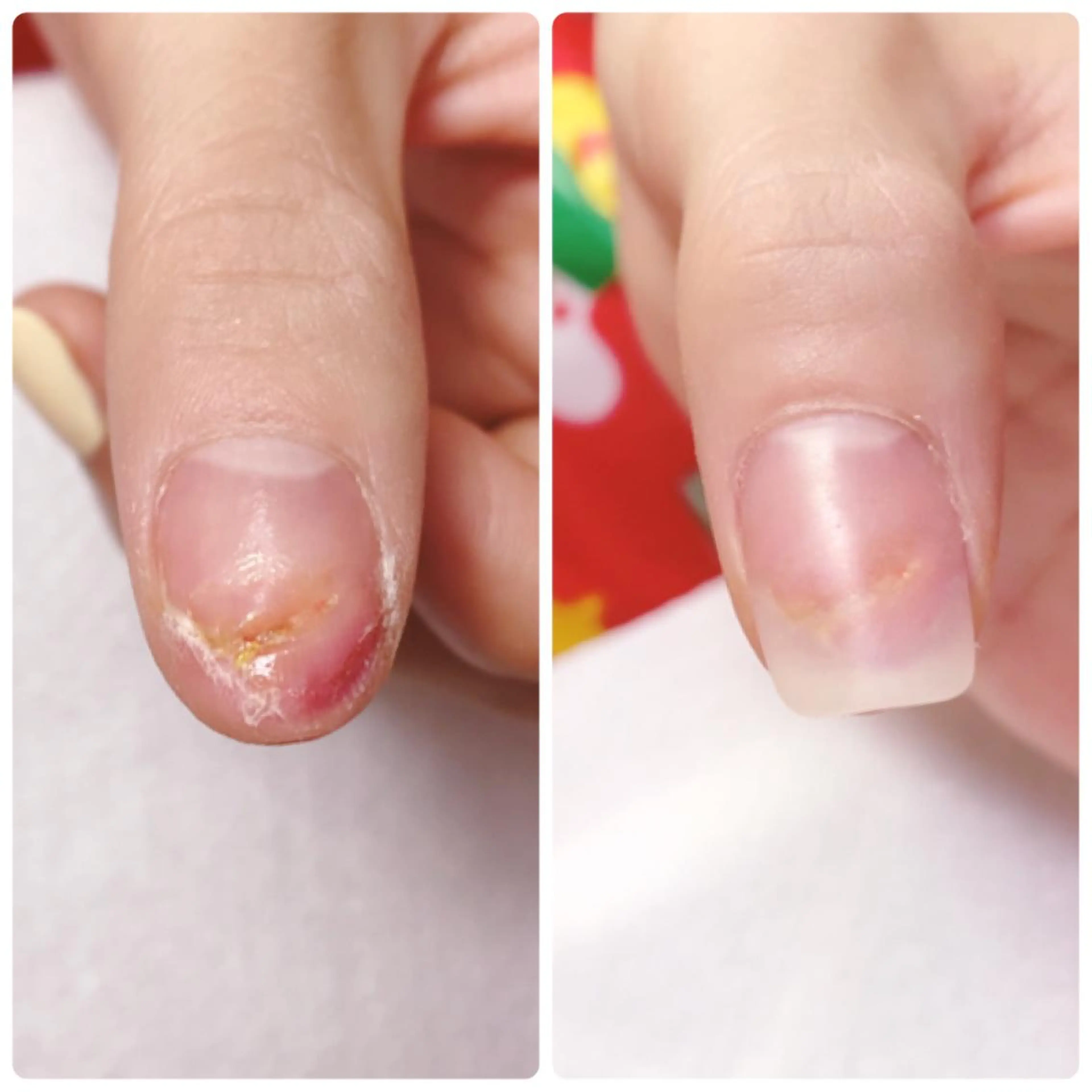 ネイル ハンドネイル 深爪を断らない スカルプ高評価店のネイルデザイン