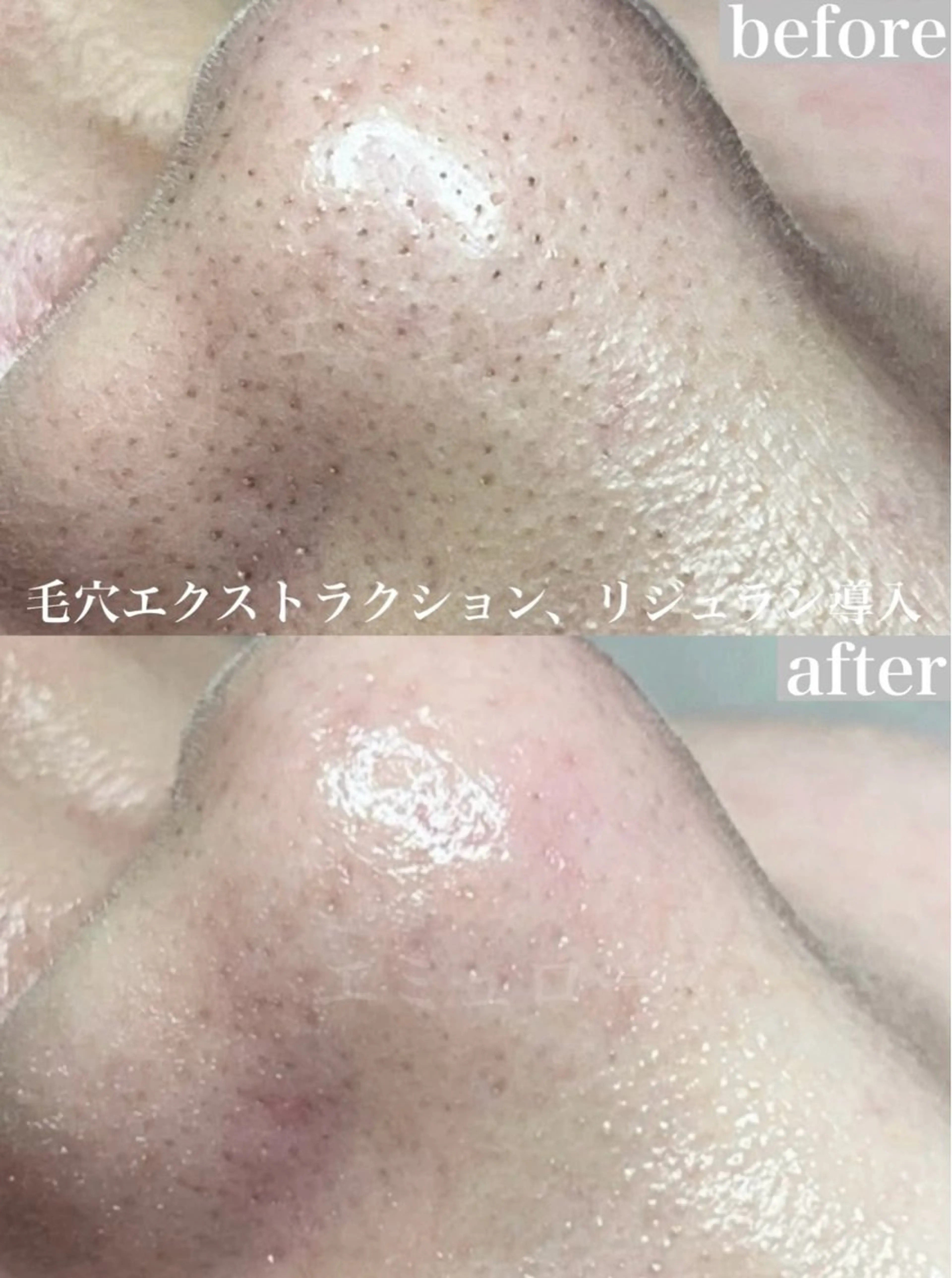 エステ リラク Nm'Rose(エミュローズ)所属・Nm'Rose .エミュローズのエステ・リラクイメージ