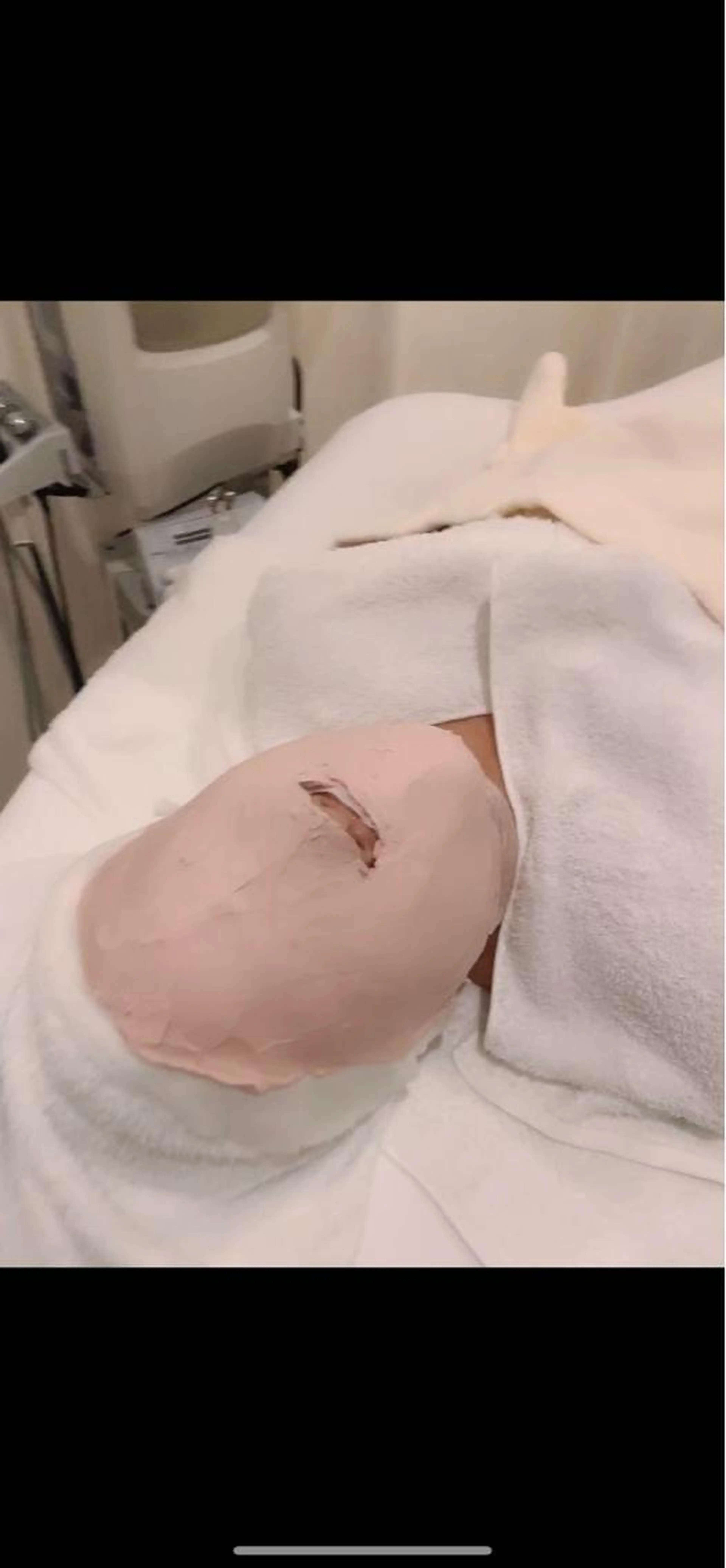 エステ【小顔・ハリ・しわ・たるみケア】リンクルショット ハリ美肌トリートメント60分 毛穴の吸引・リンパドレナージュ付きの写真