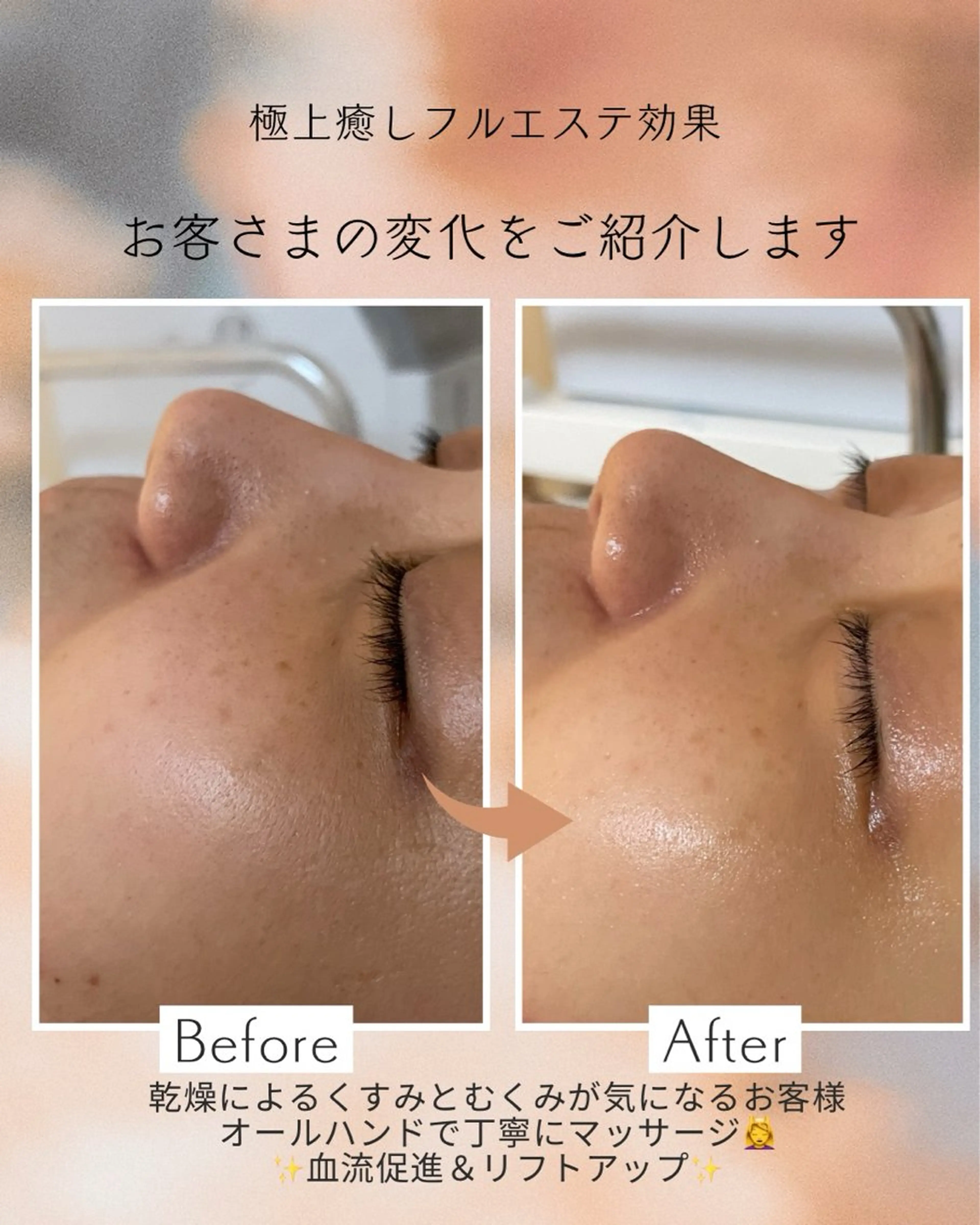 エステ リラク skinLabo所属・saya Mのエステ・リラクイメージ