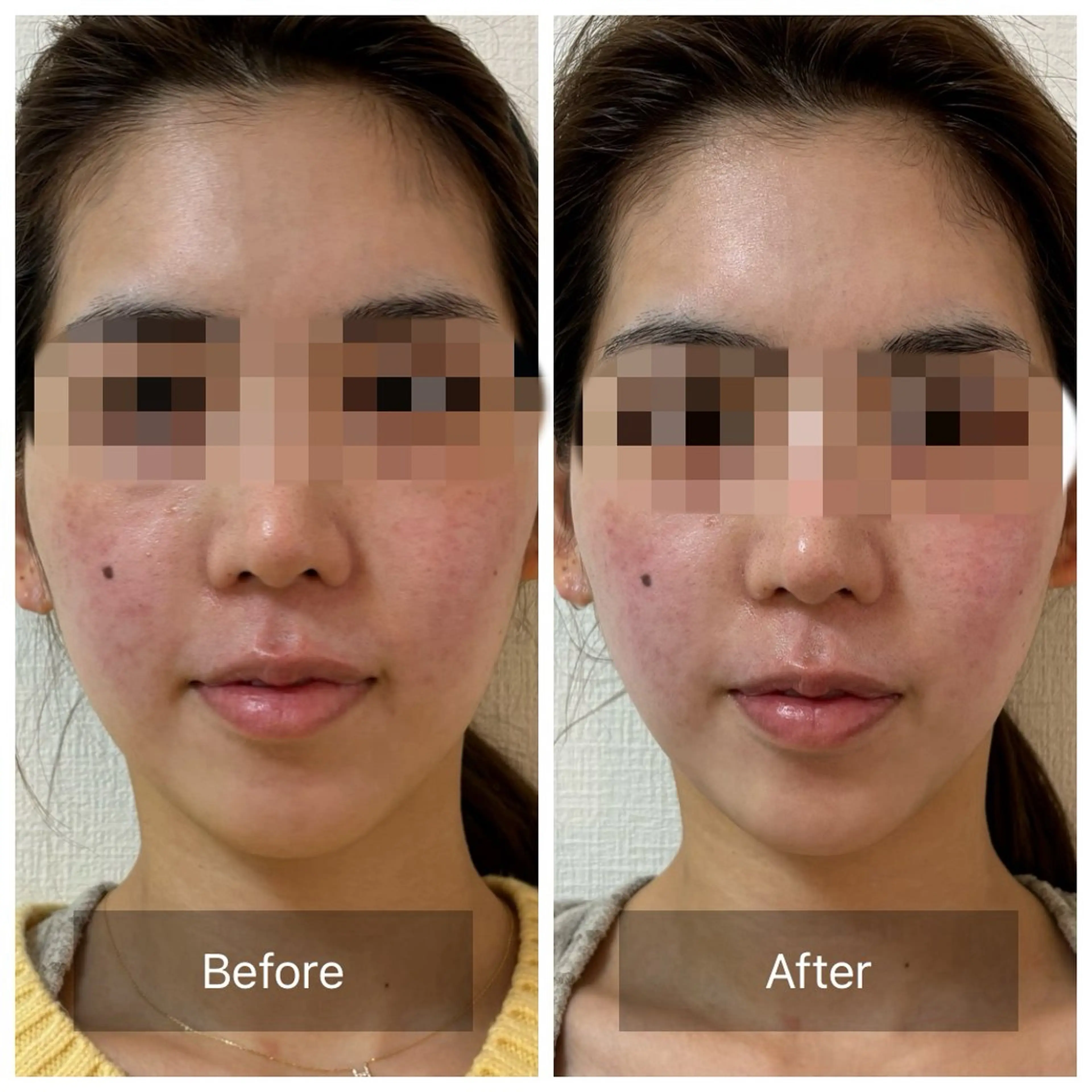 夕方まで！〈選べるフェイシャル〉お試し 30分 くすみ、小顔、たるみ、しみ、光ケアの写真