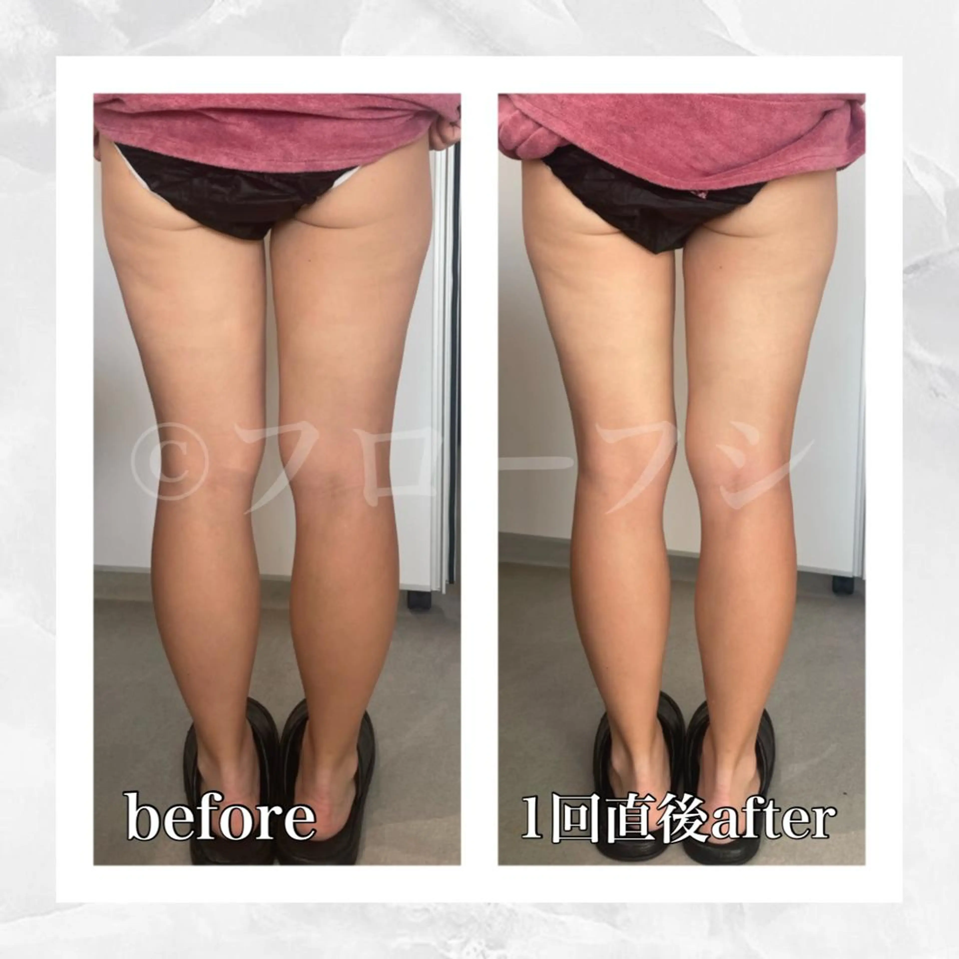 エステ リラク 部分痩せ♥️小顔専門 MIKUのエステ・リラクイメージ