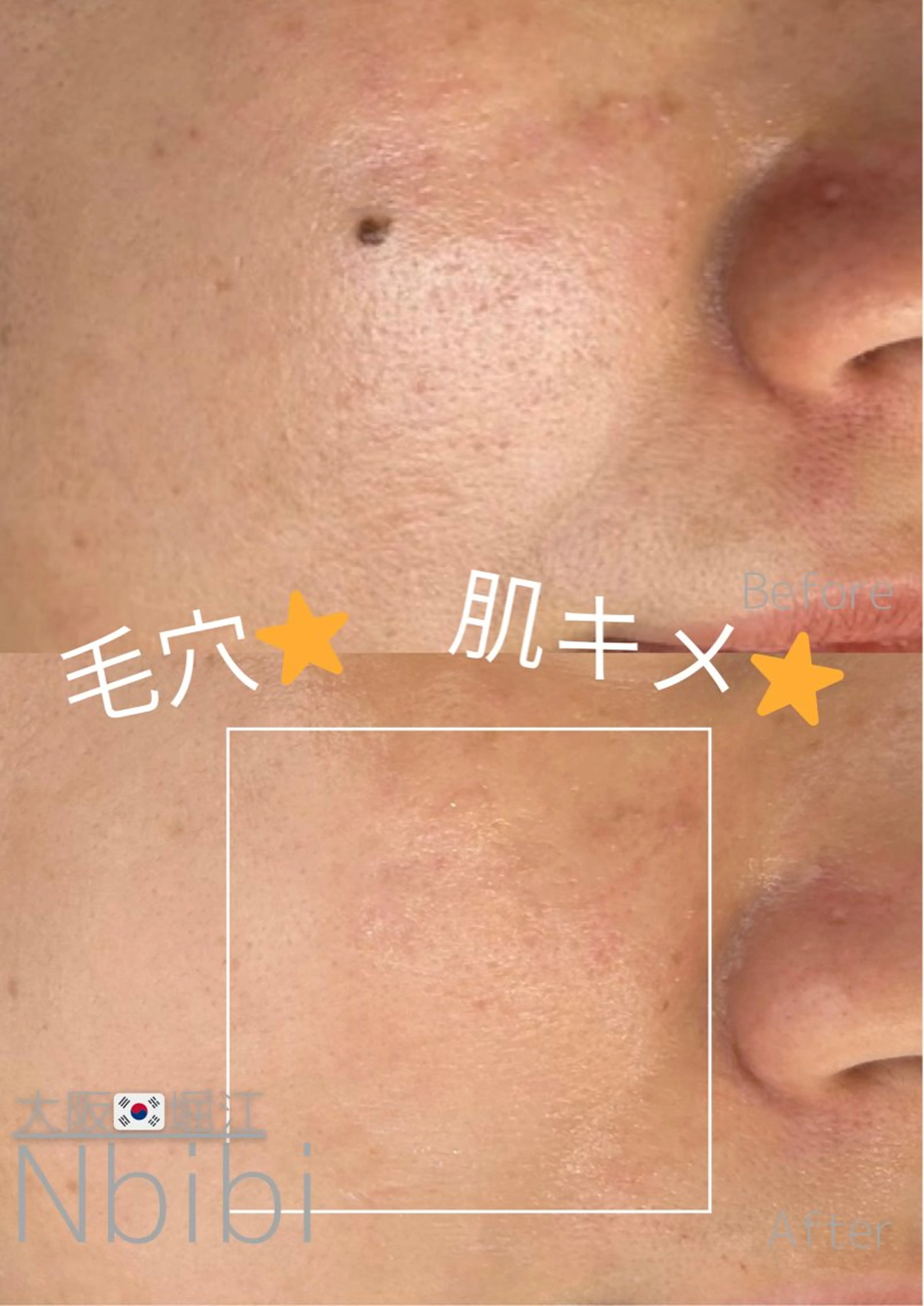 韓国🇰🇷価格 サロン_Nbibiのエステ・リラクイメージ