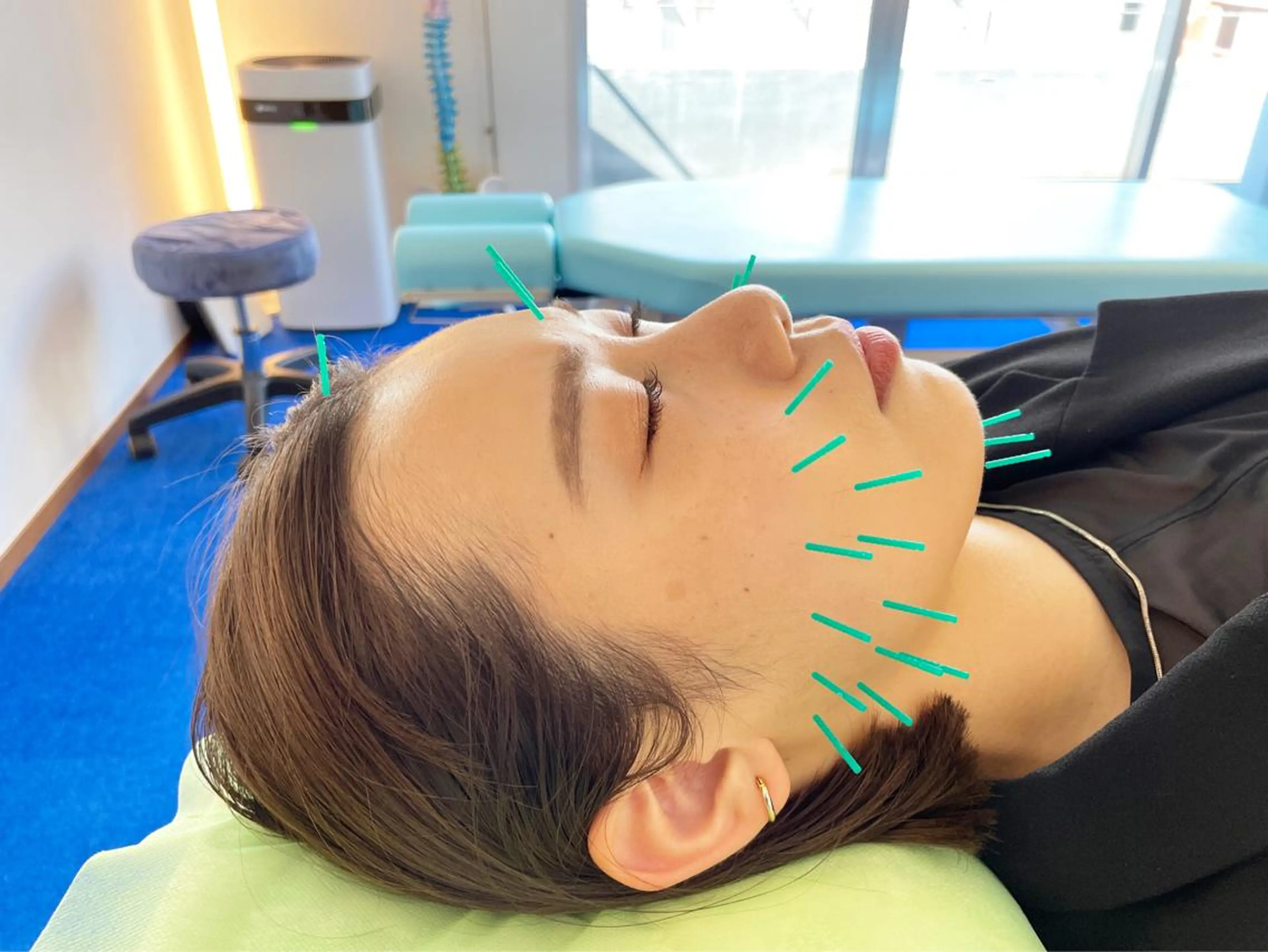 エステ リラク 小顔美容鍼専門サロン 渋谷YZのその他イメージ