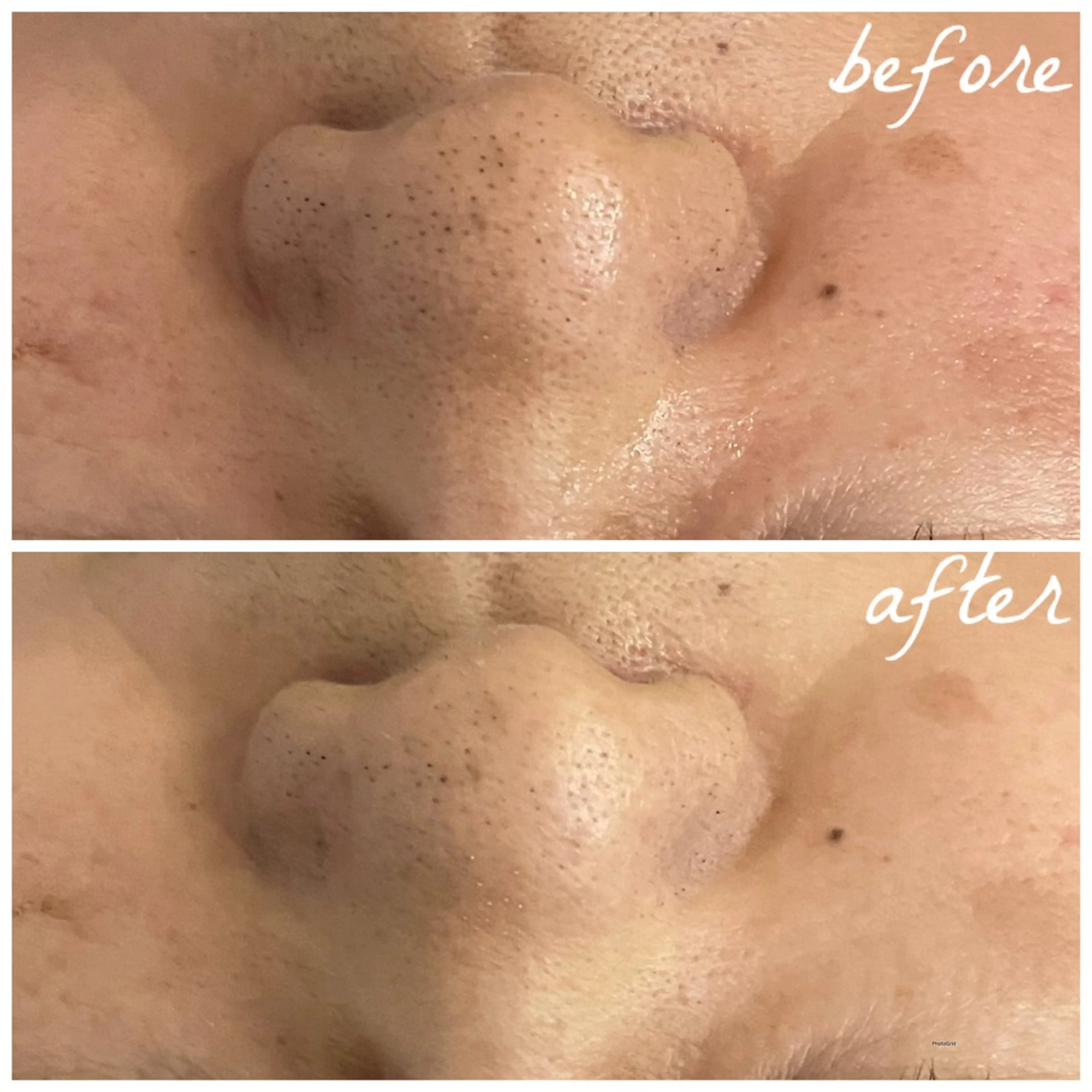 メンズ メナード岐阜茜部 杉浦のエステ・リラクイメージ