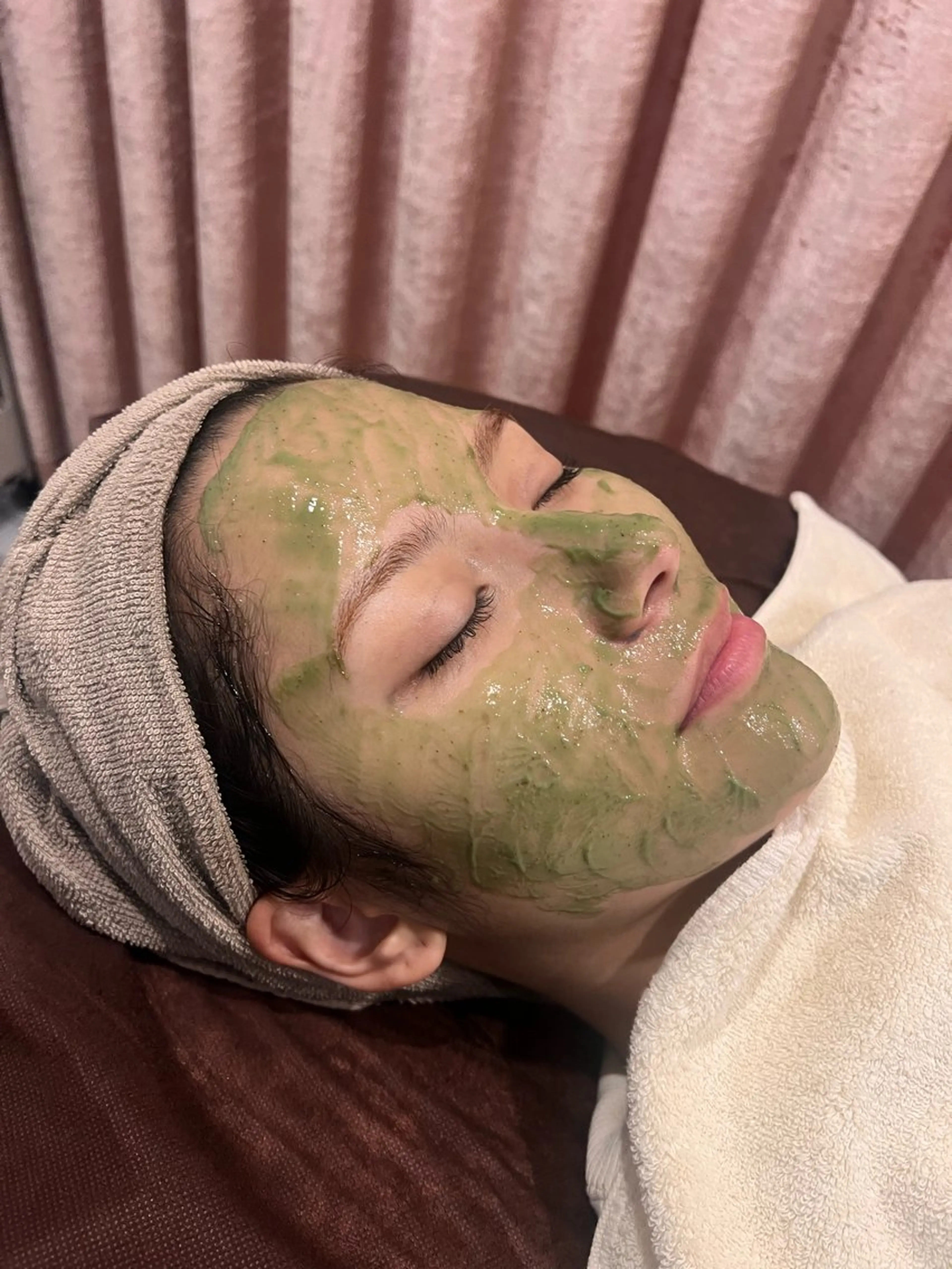 【2回目以降】次世代ハーブピーリングで肌土台強化✨すっぴんでも自信の持てるお肌へ♡剥離なし、ダウンタイムなし！ブライダルの写真