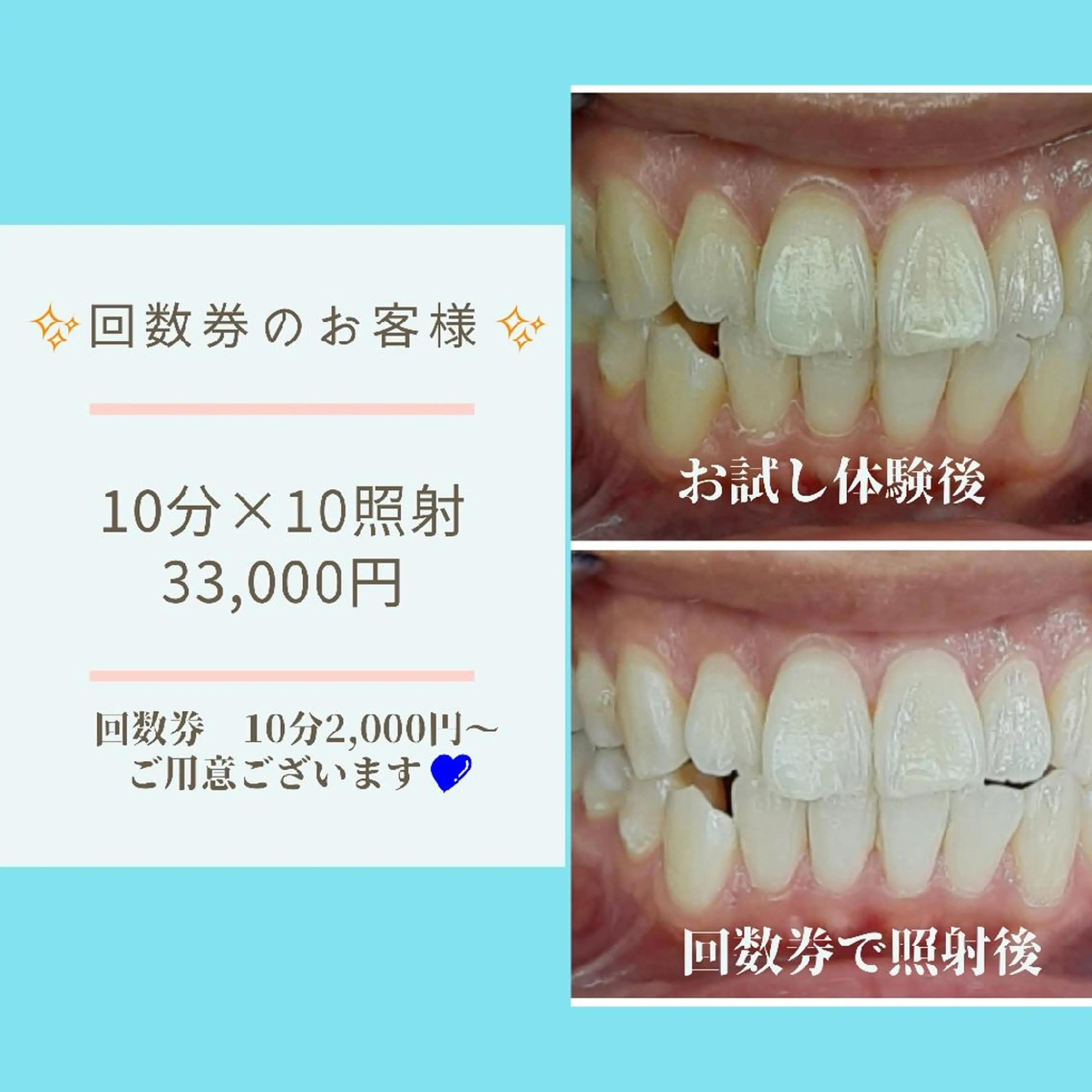 五十嵐 蓮のその他イメージ