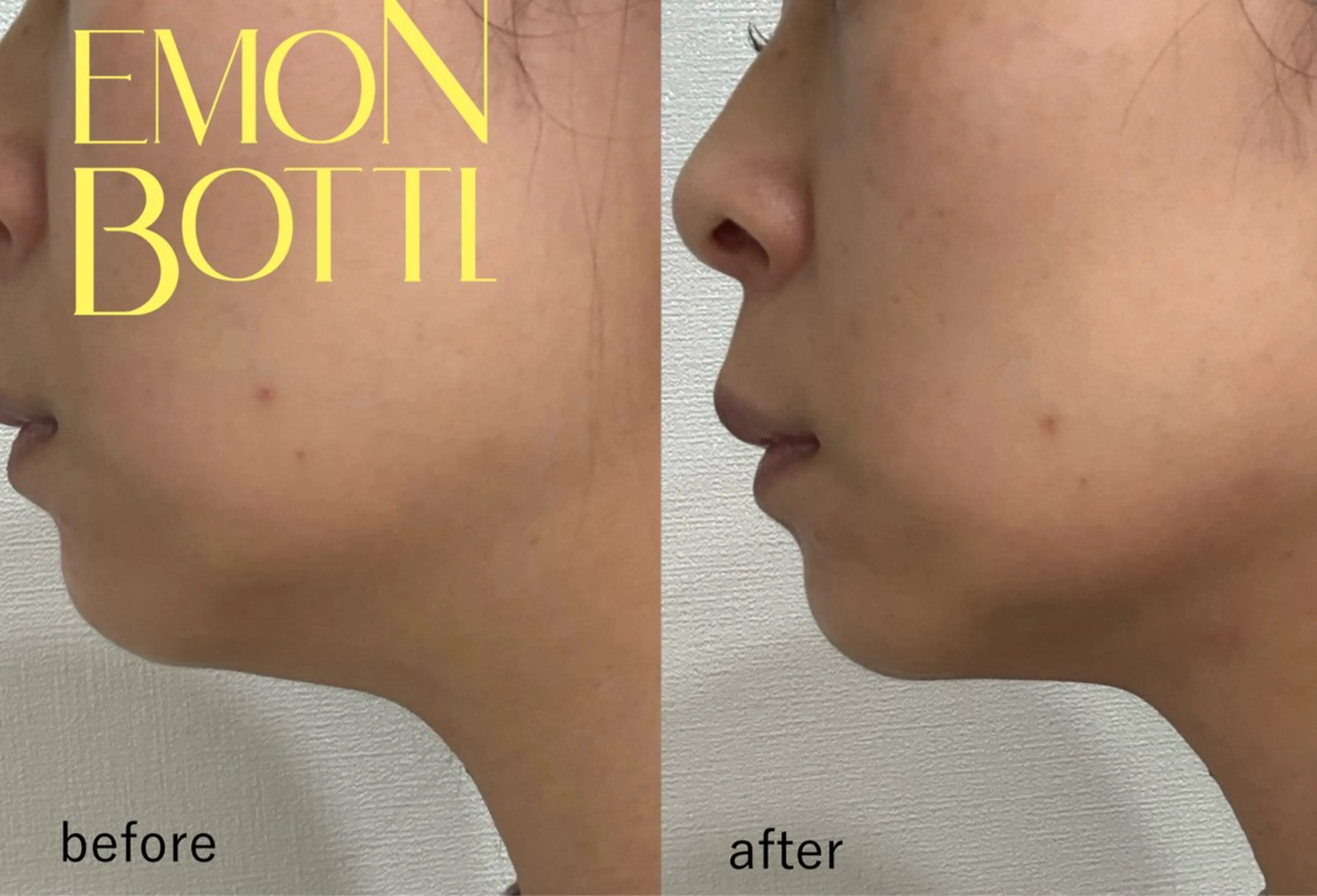 お顔のたるみに！脂肪を撃退レモン🍋ボトルの写真