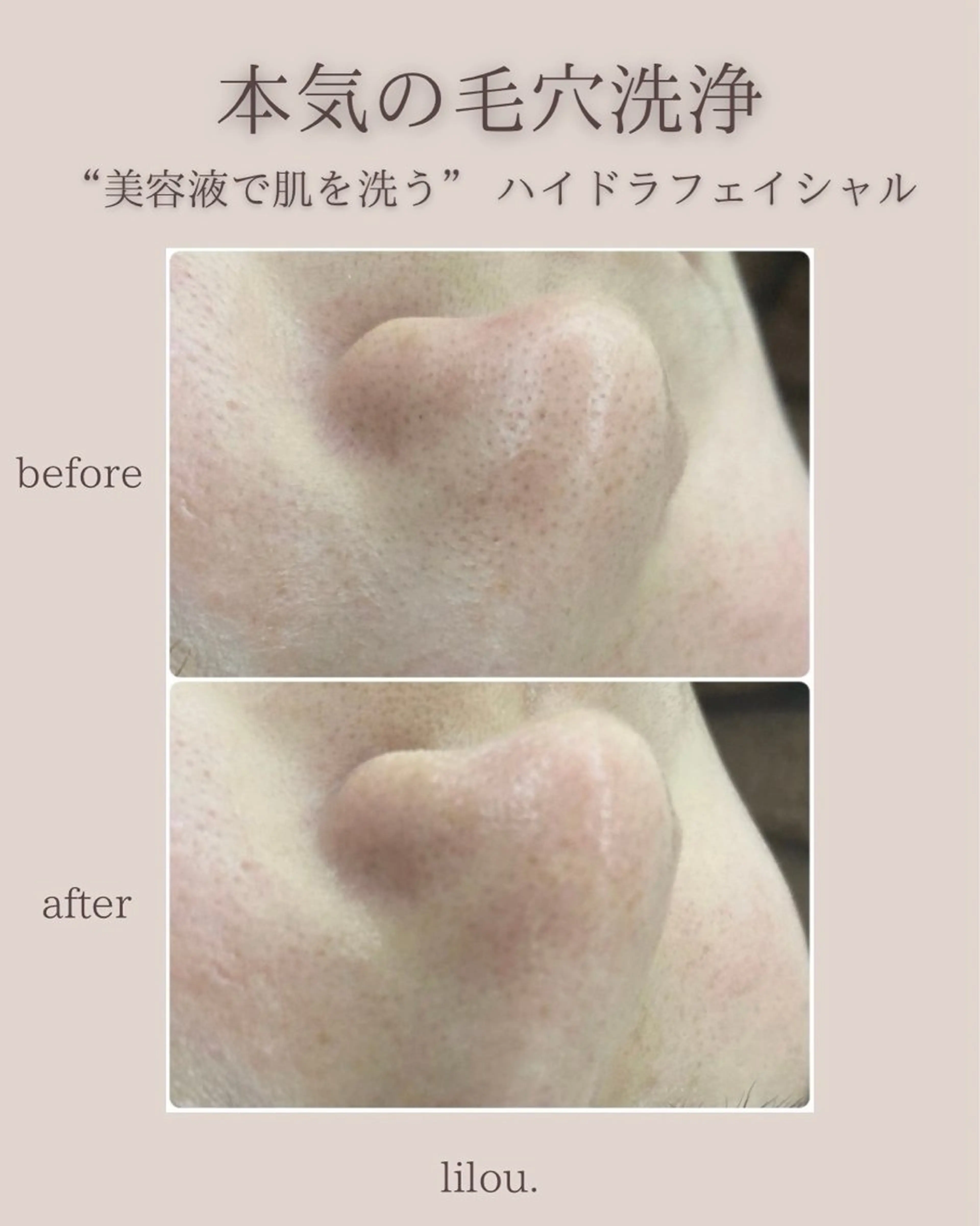 吉田 hue.のエステ・リラクイメージ