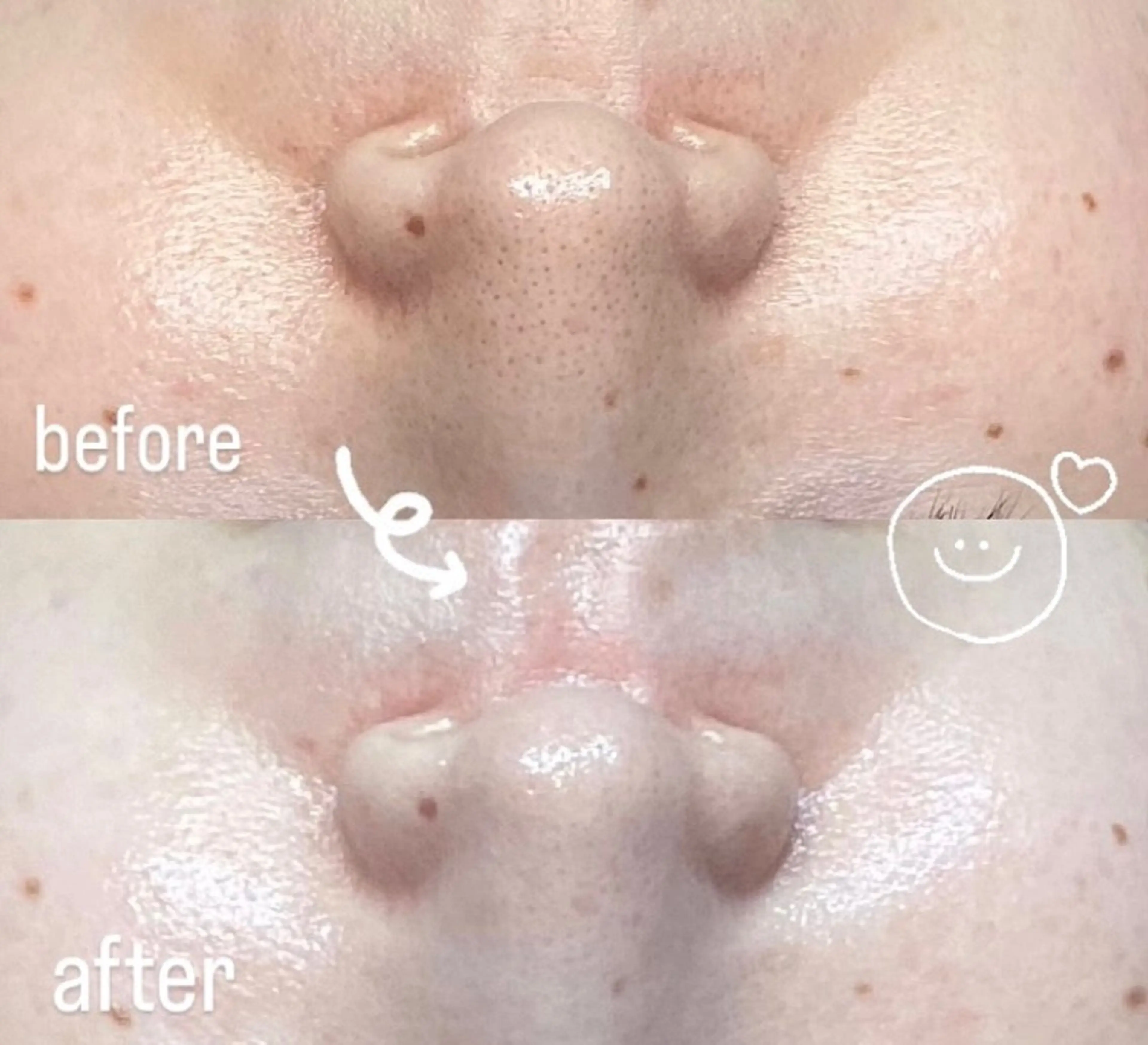 Rifuro 勝田台エステ所属・Rifuro勝田台 ララピール・毛穴洗浄のエステ・リラクイメージ