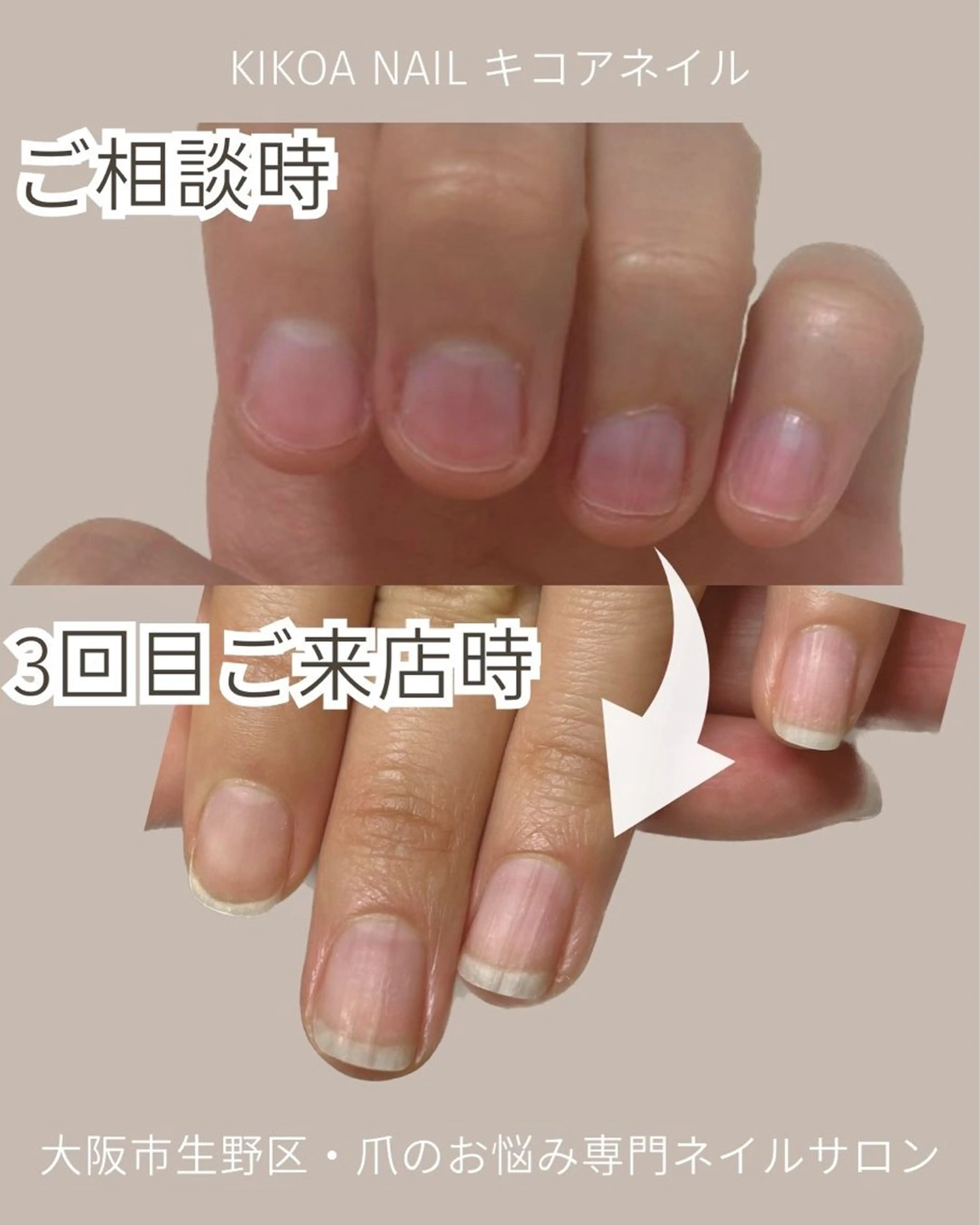 ネイル KIKOA NAIL キコアネイルのネイルデザイン