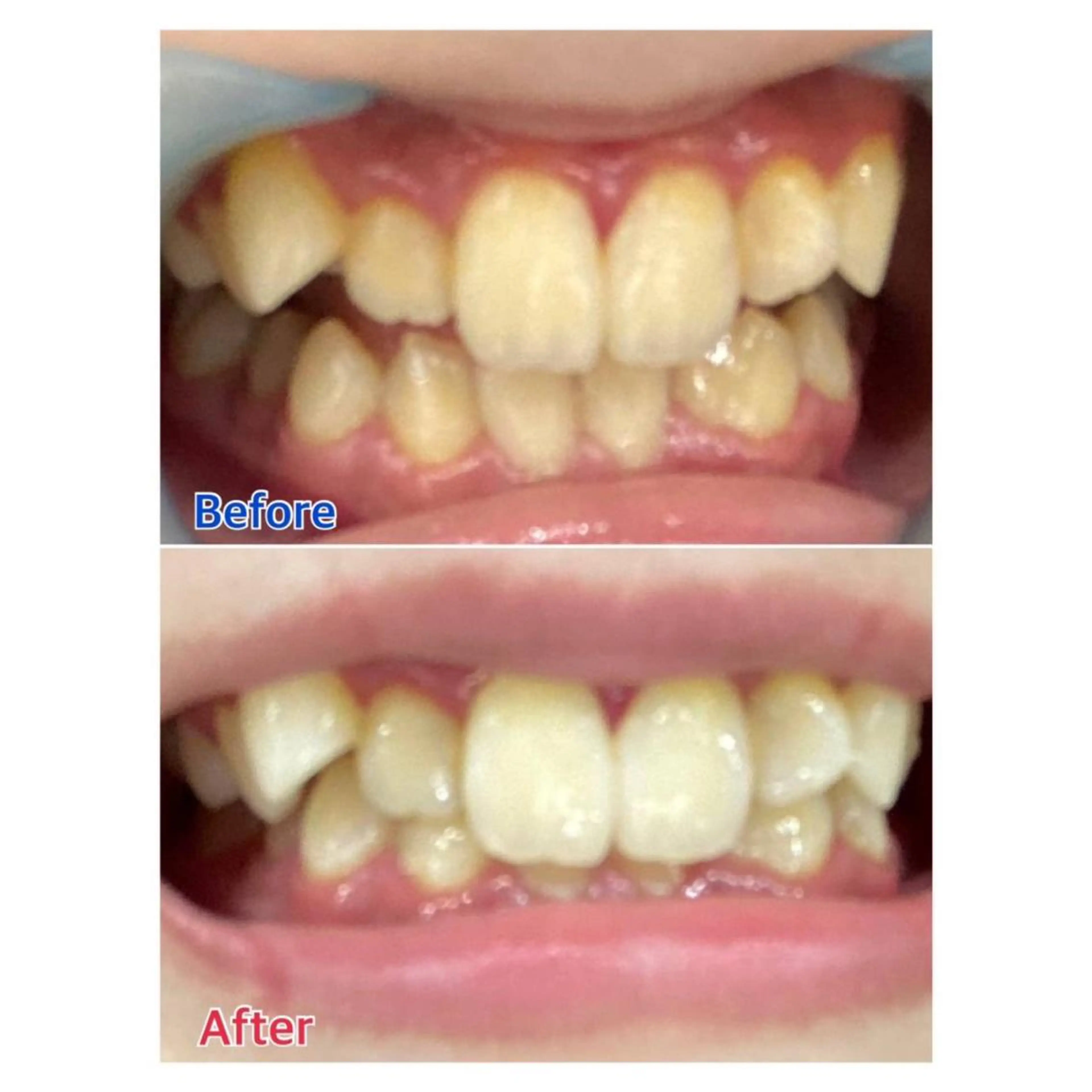 MBEAUTYSALON 千葉店・京成大久保所属・Melty 輝のその他イメージ