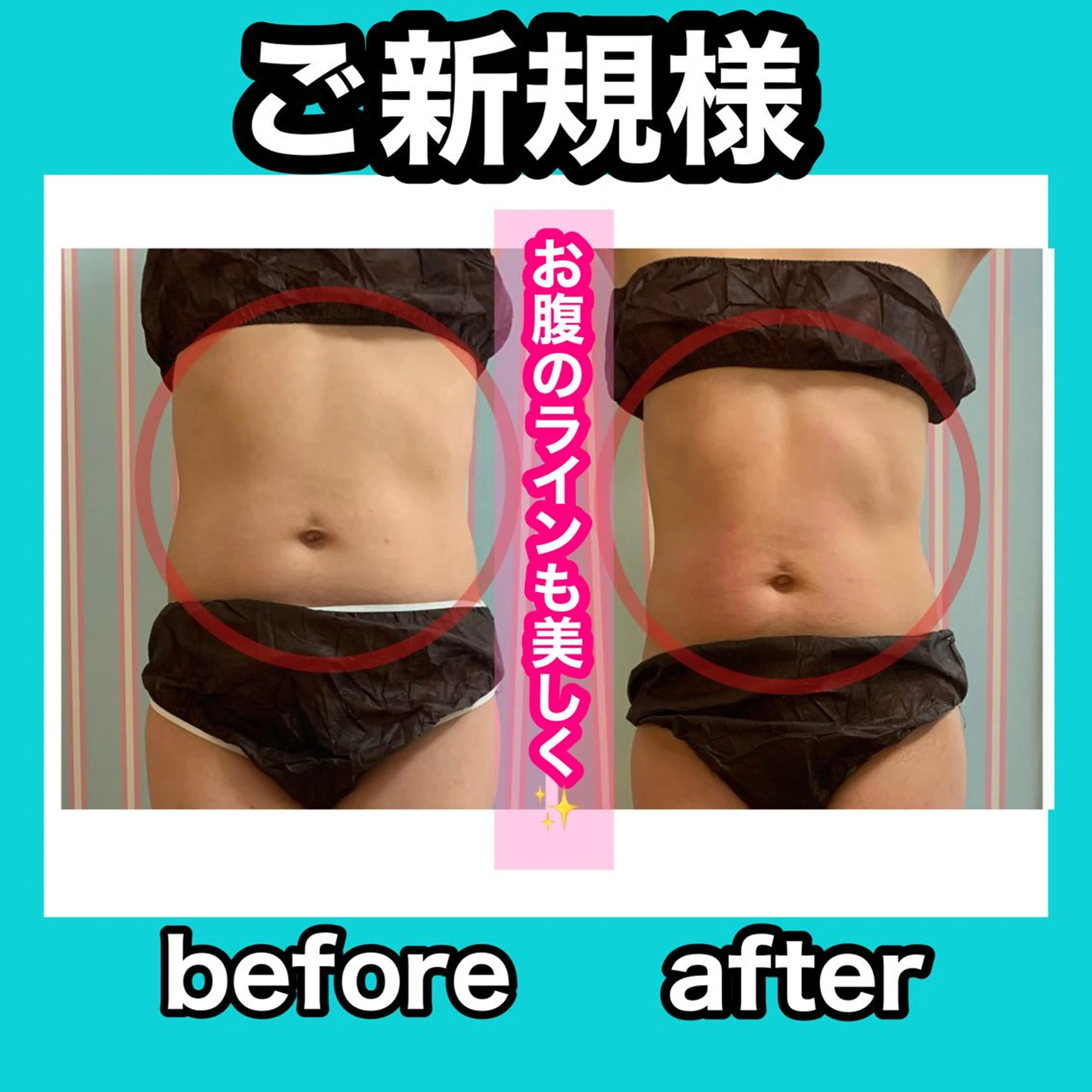 エステ リラク 痩身/脱毛/ネイル HARUKAのエステ・リラクイメージ