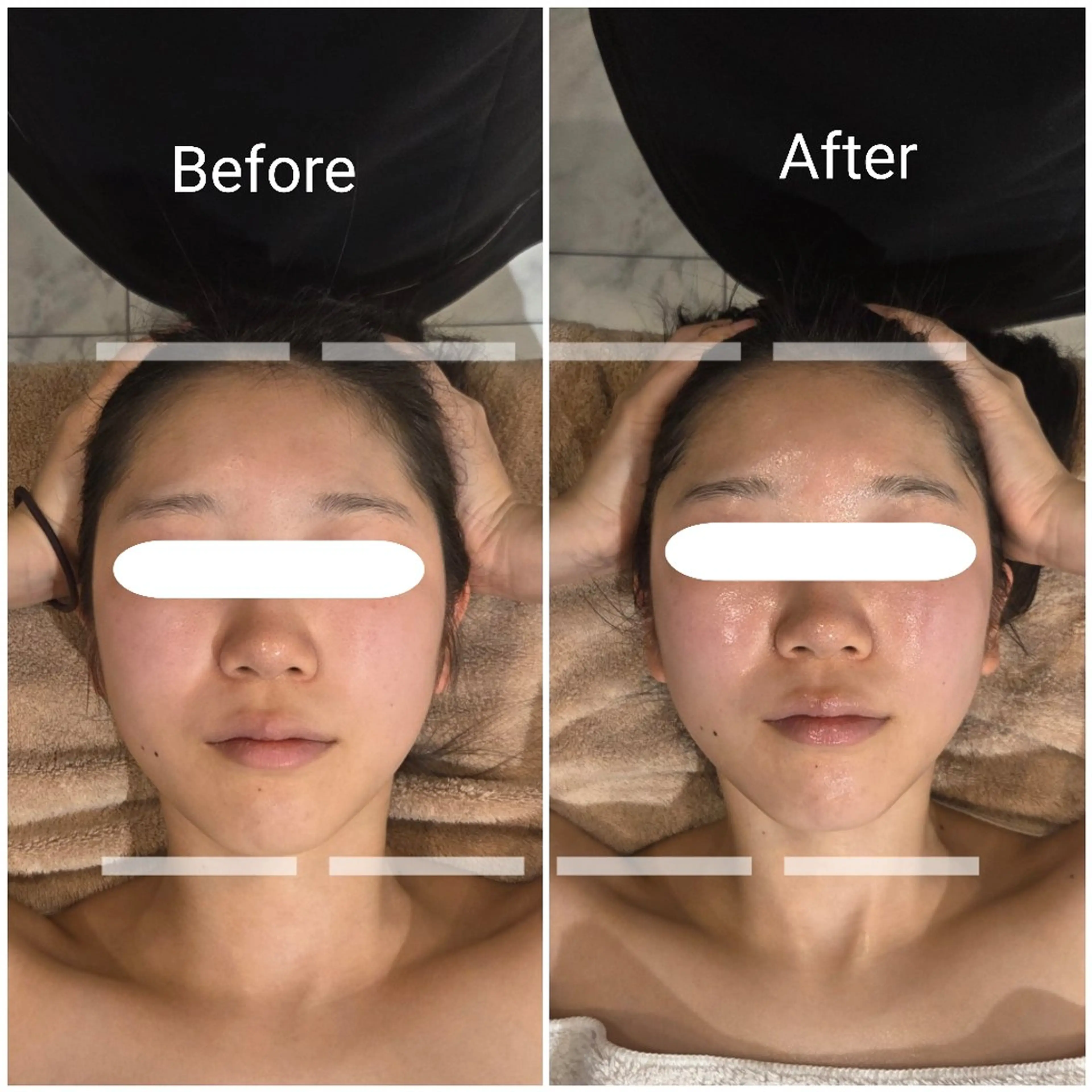 フェイシャル贅沢ケア♪  小顔 リフトアップ たるみ ほうれい線ケアの写真