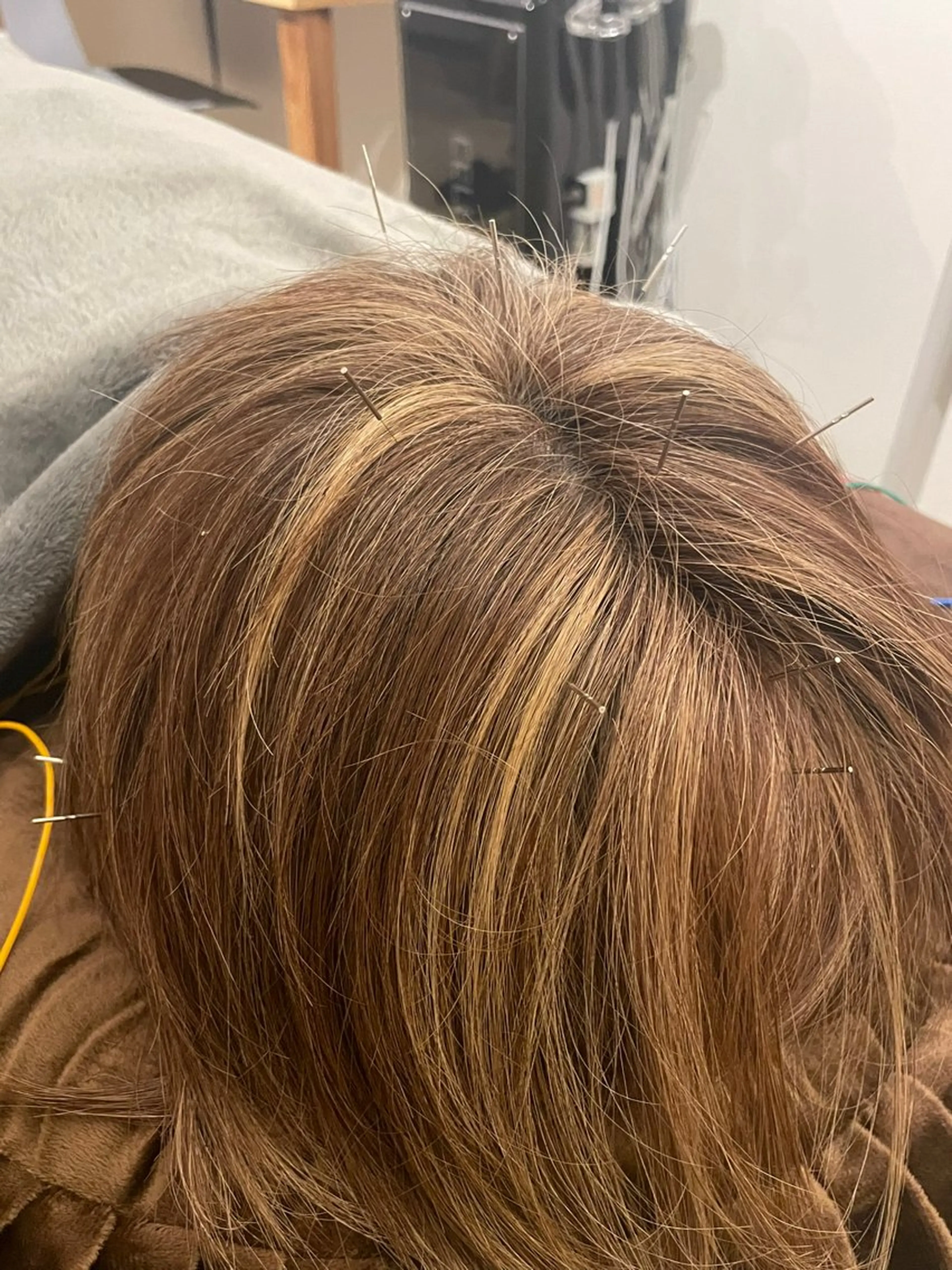 美容鍼/鍼灸 ここみ鍼灸院のエステ・リラクイメージ