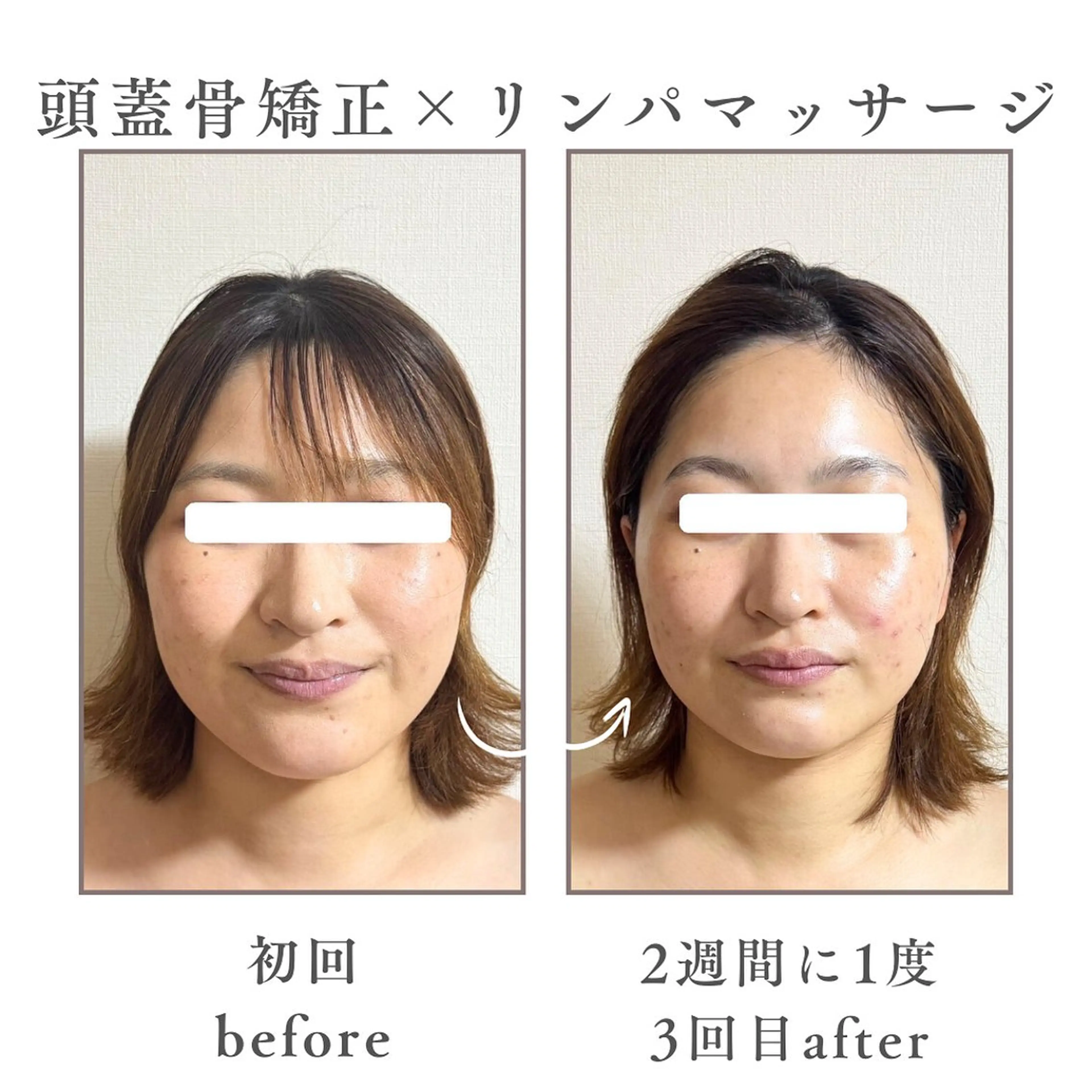 Mignon Lulu🎀のエステ・リラクイメージ